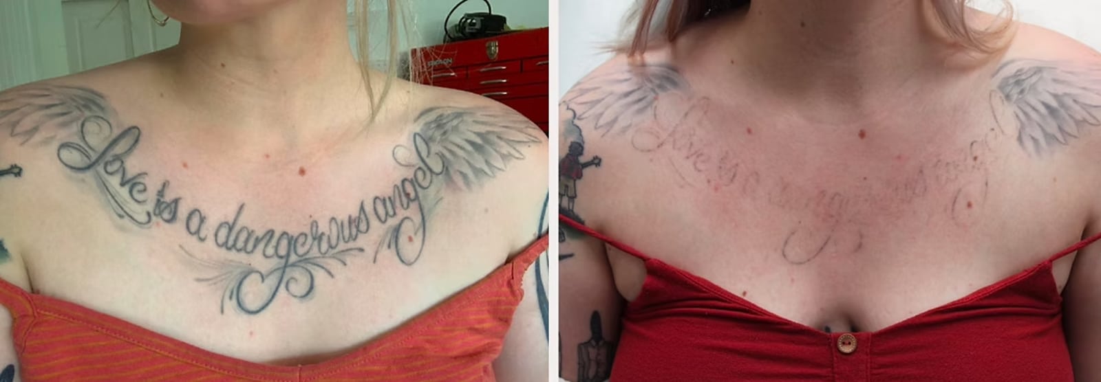 Tattoo Fading for Cover-Ups