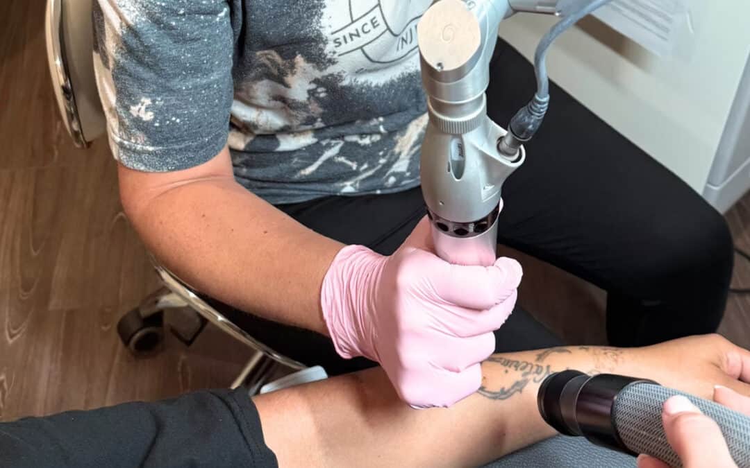 PicoWay vs. Older Laser Technology: Why Faster Tattoo Removal Near Me Is Now Possible