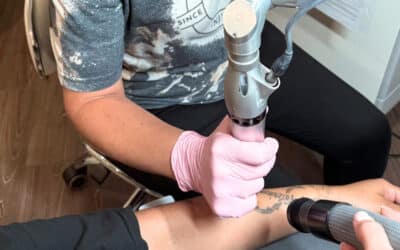 PicoWay vs. Older Laser Technology: Why Faster Tattoo Removal Near Me Is Now Possible