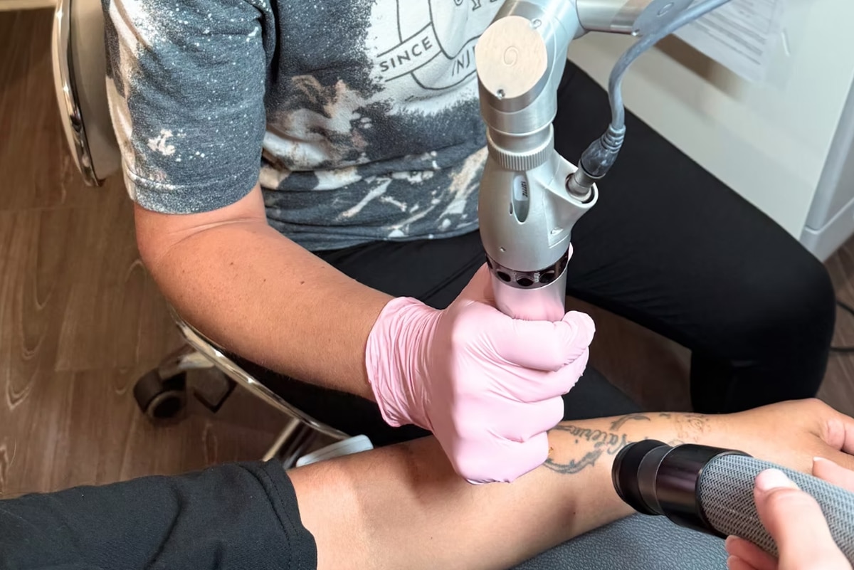 Faster Tattoo Removal Faster Tattoo Removal