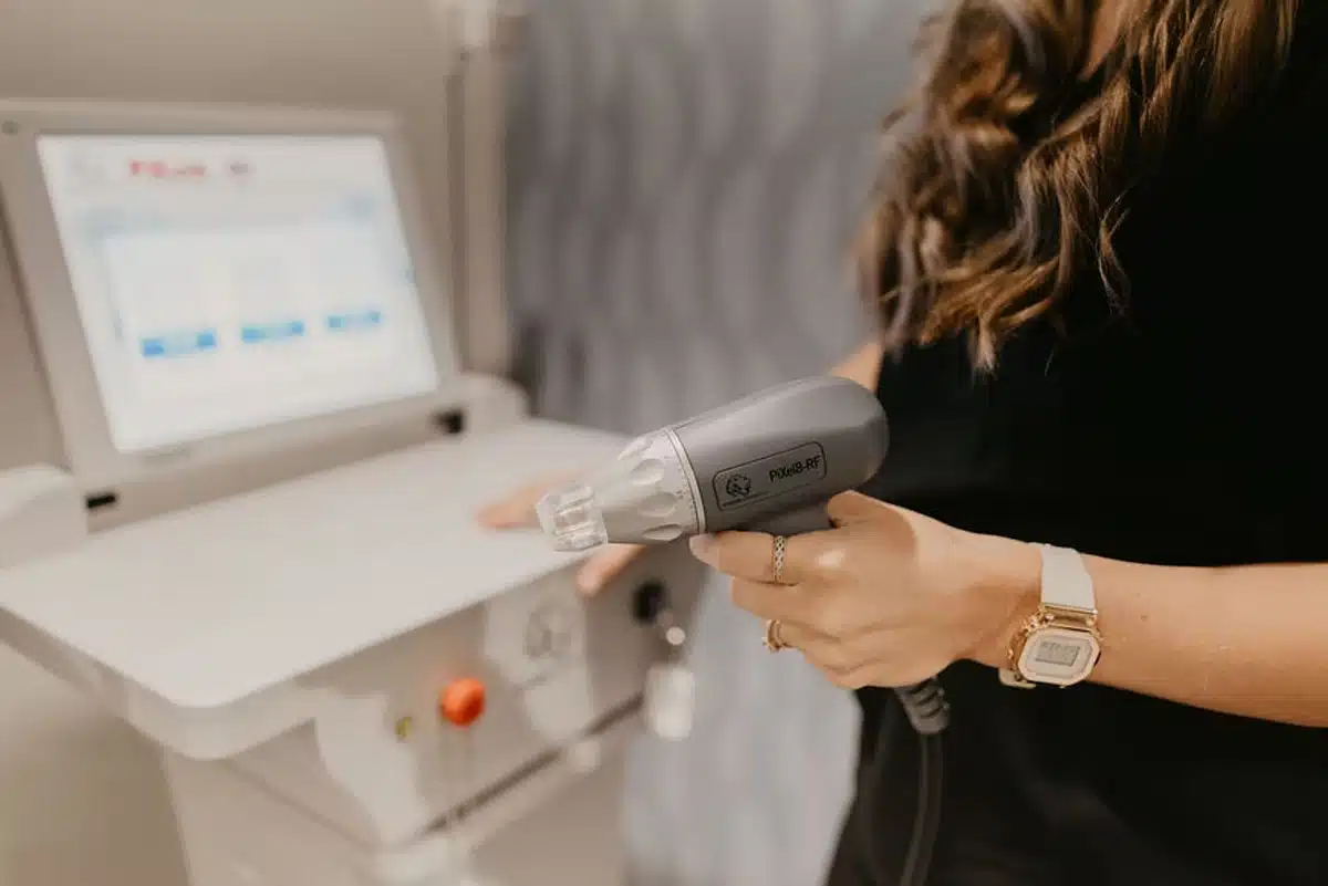 RF MICRONEEDLING RF Microneedling