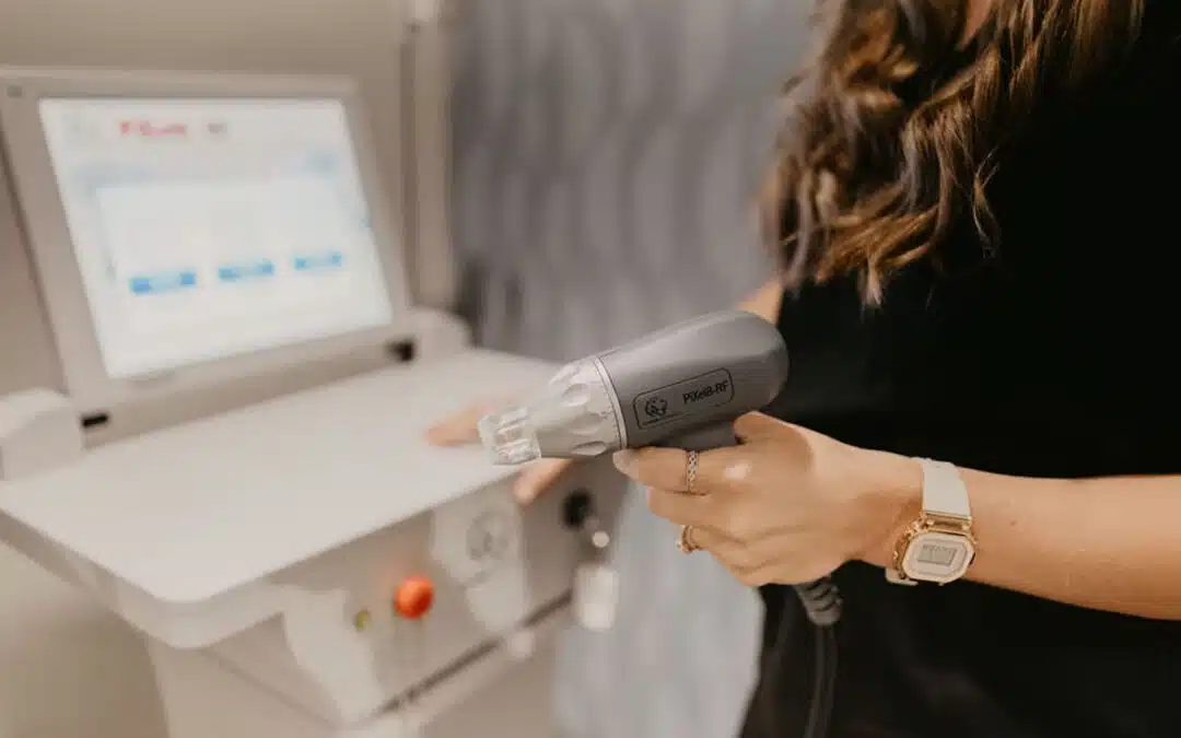 Unlock Radiant Skin with RF Microneedling in Winston-Salem