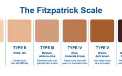 Tattoo Removal and Skin Type: Tattoo Removal Winston-Salem