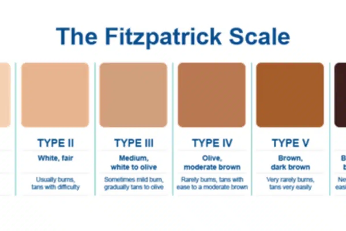 Tattoo Removal Winston-Salem