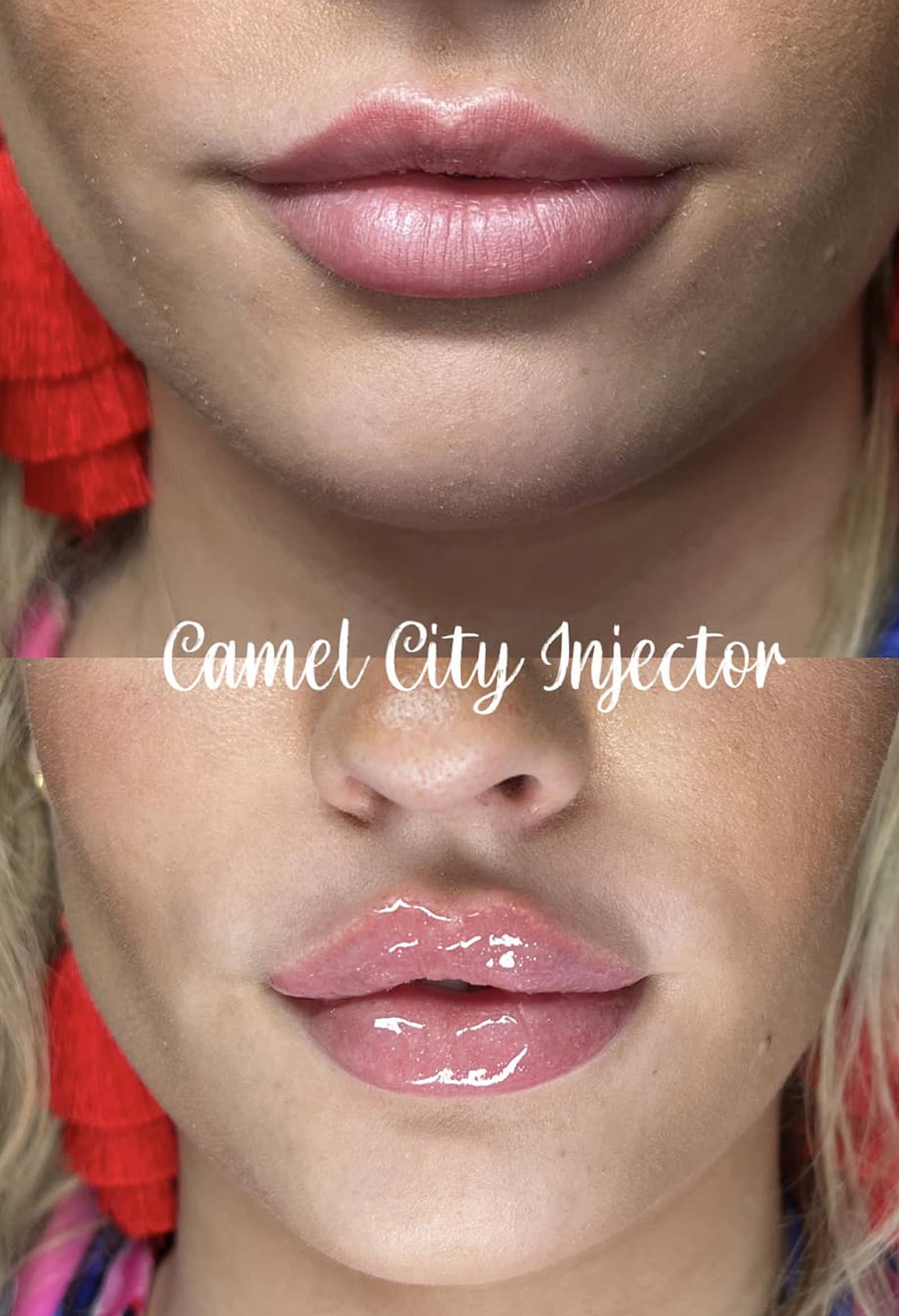 Camel City Injector Is Winston‑Salem’s Trusted Choice Camel City Injector Is Winston‑Salem’s Trusted Choice