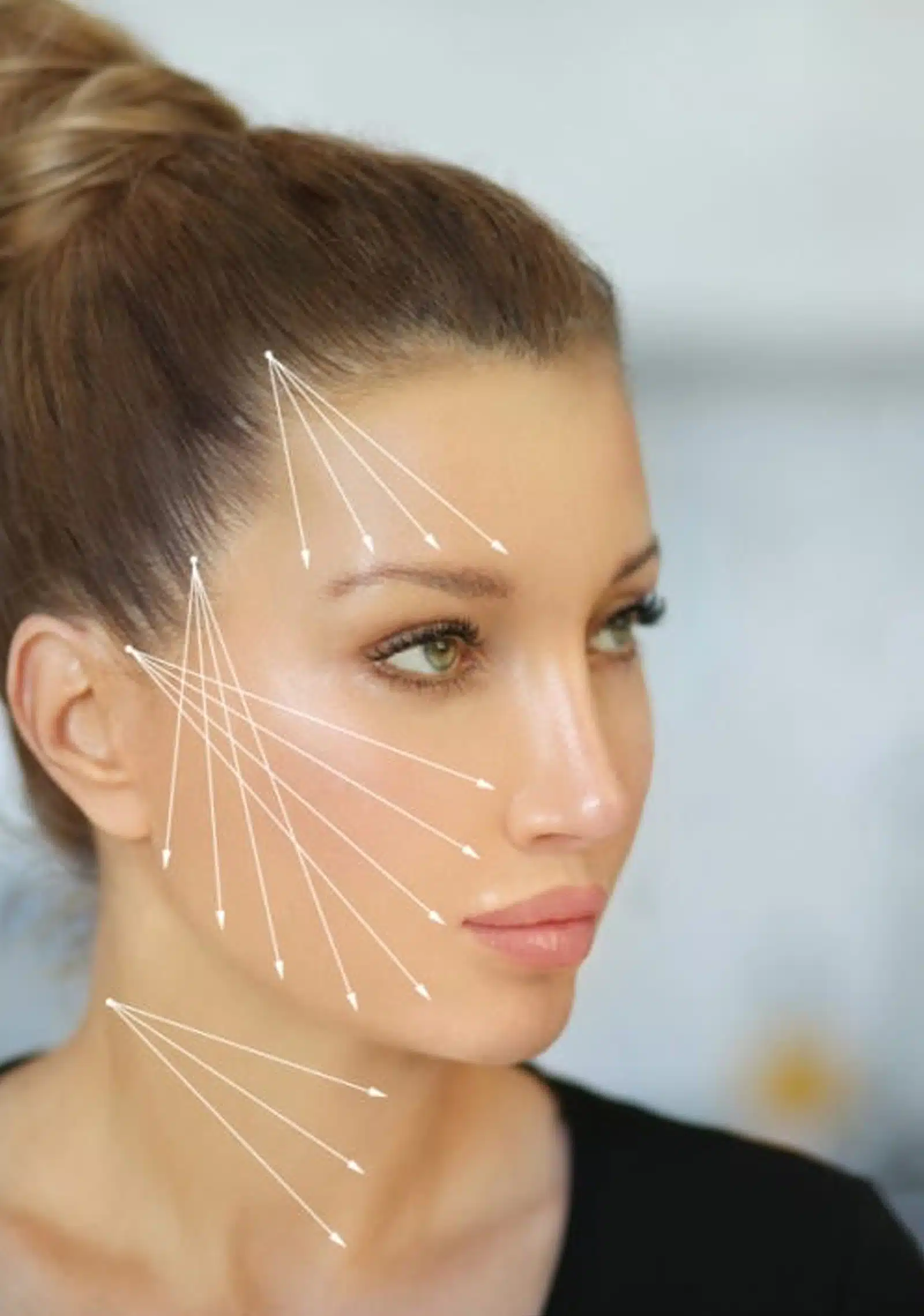 Benefit from a Thread Lift