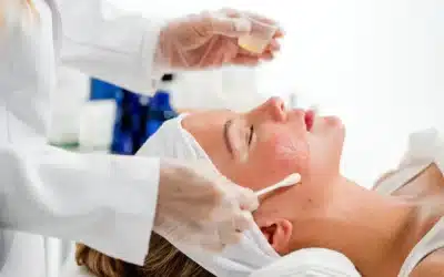 Chemical Peels 101: Best Treatments for Glowing Skin in King, NC