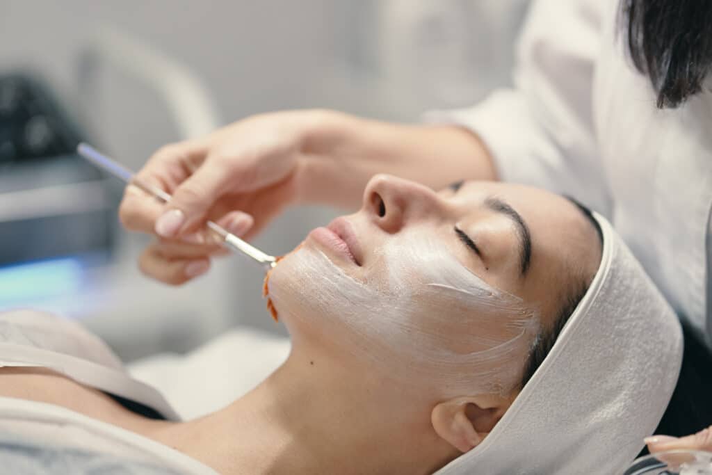 Chemical Peels 101
