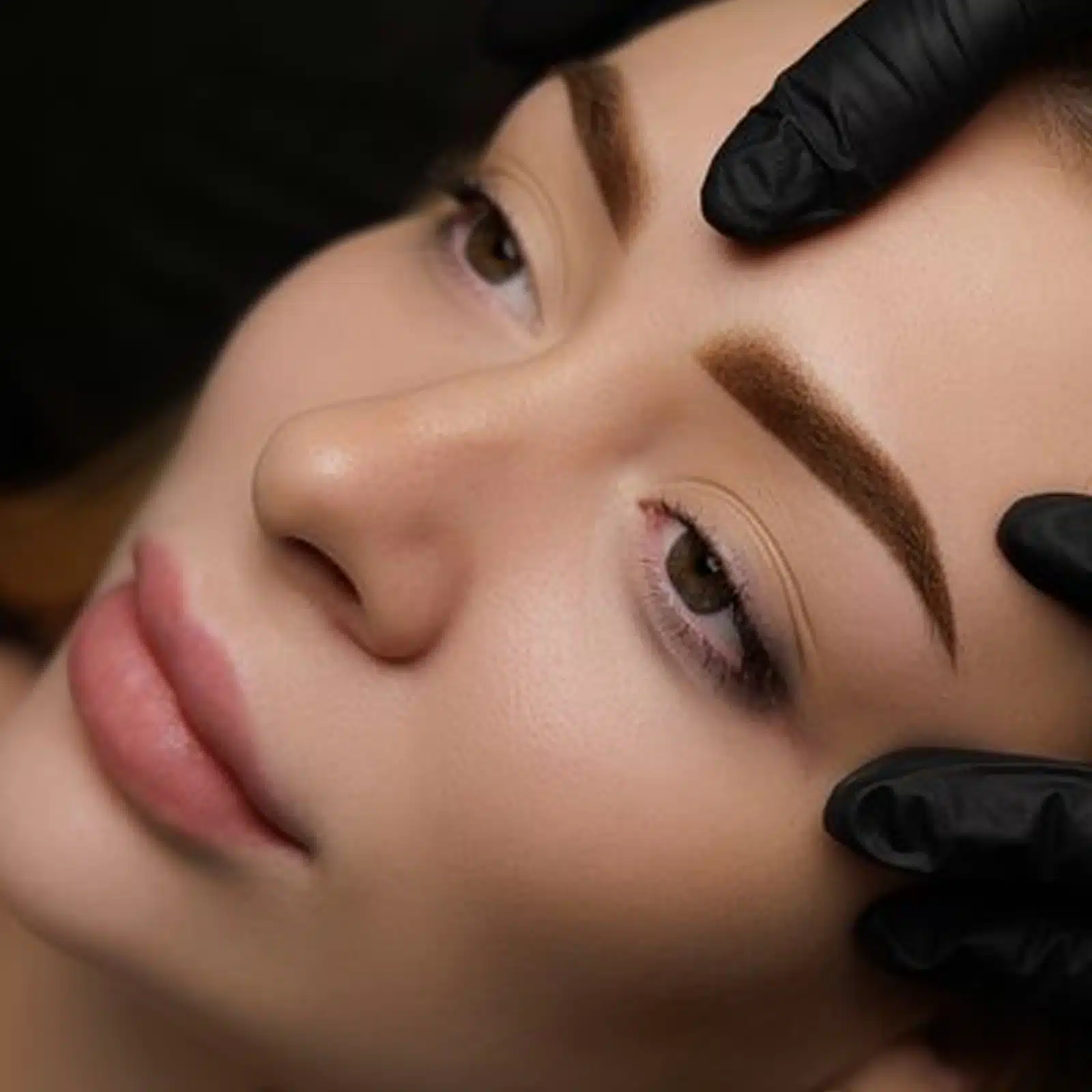 Thread Lifts Over Surgery