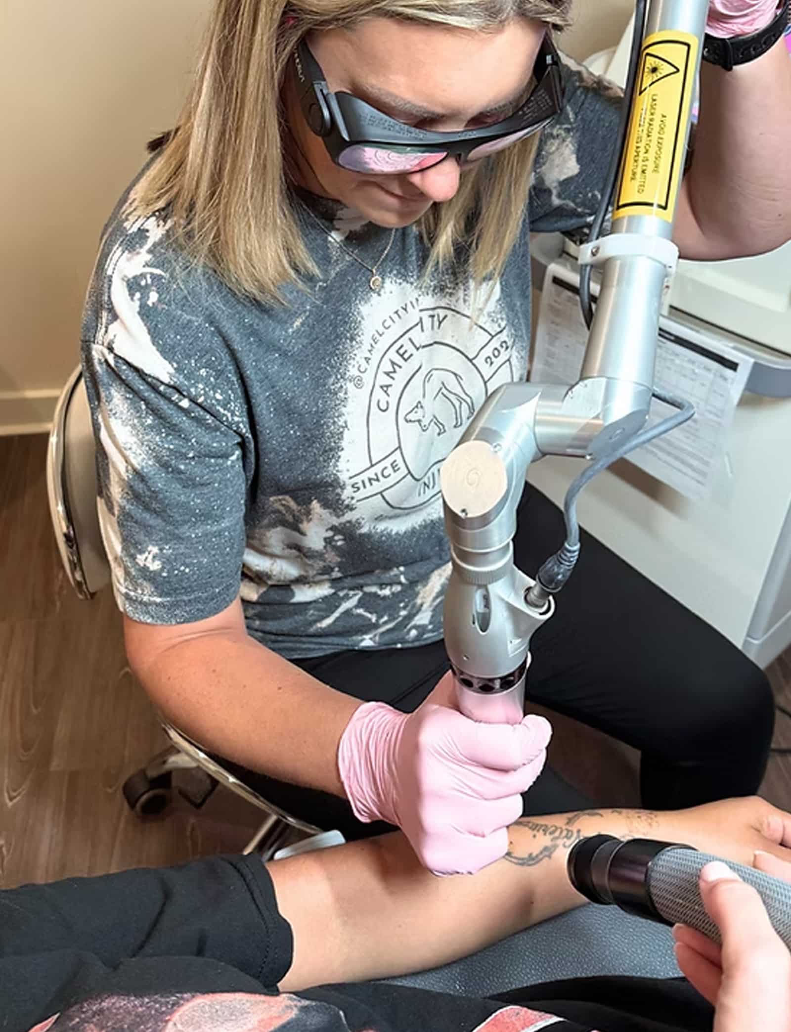 Beyond Tattoo Removal tattoo removal