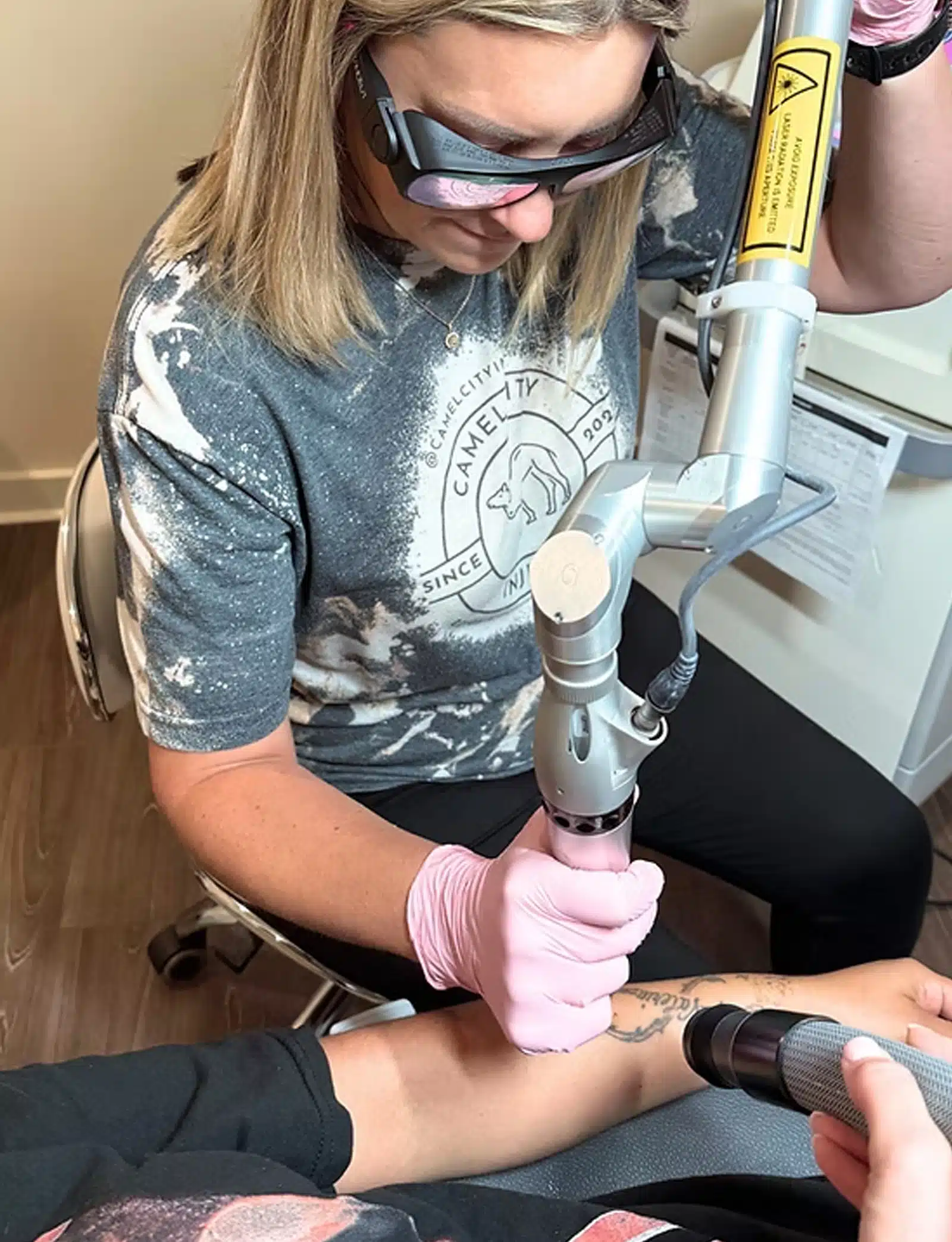 tattoo removal 