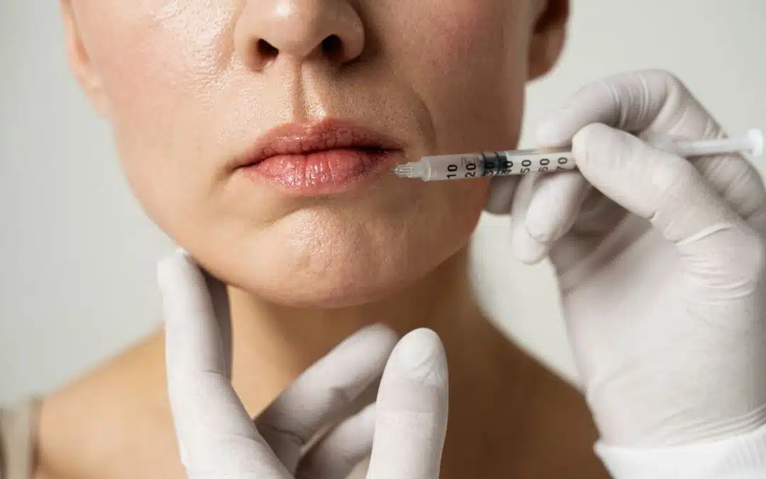 Top Certified Lip Filler Injector Near Greensboro: Your Comprehensive Guide to Safe and Beautiful Results