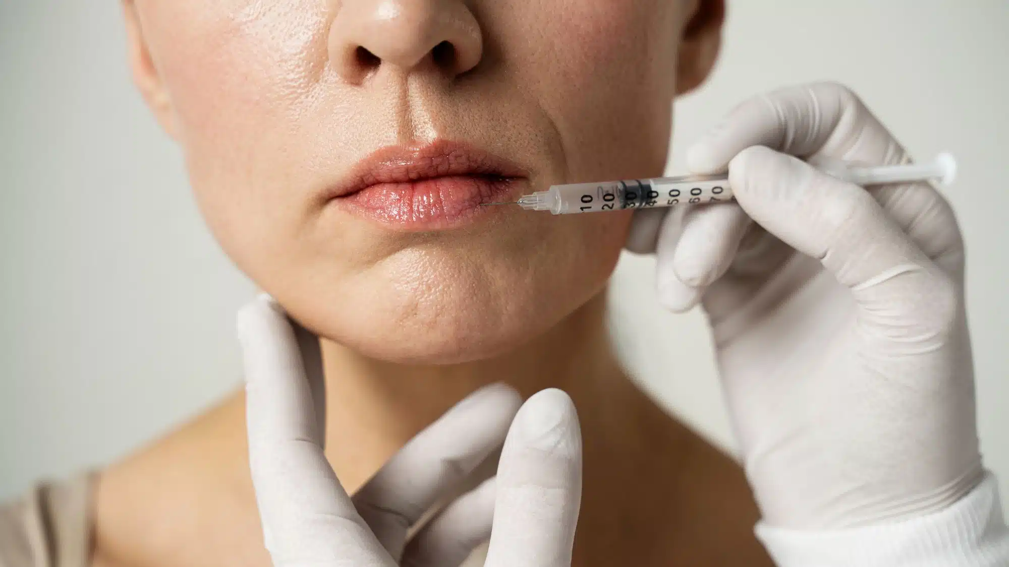 Certified Lip Filler Injector Near
