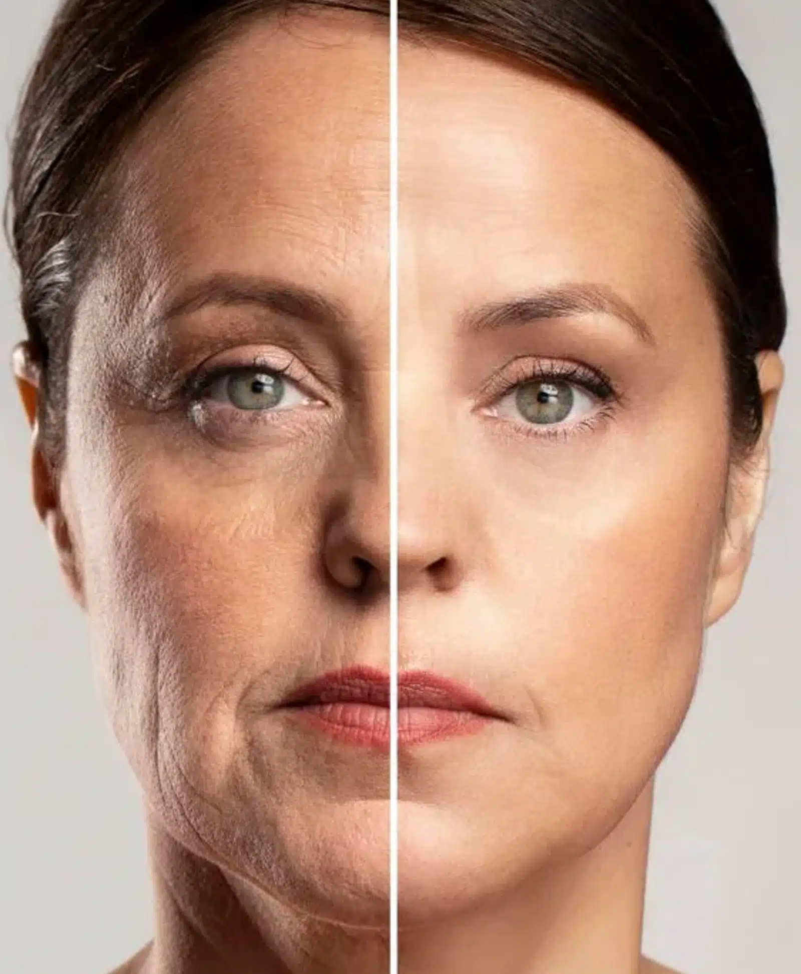 Combining Masseter Botox with Other Facial Treatments