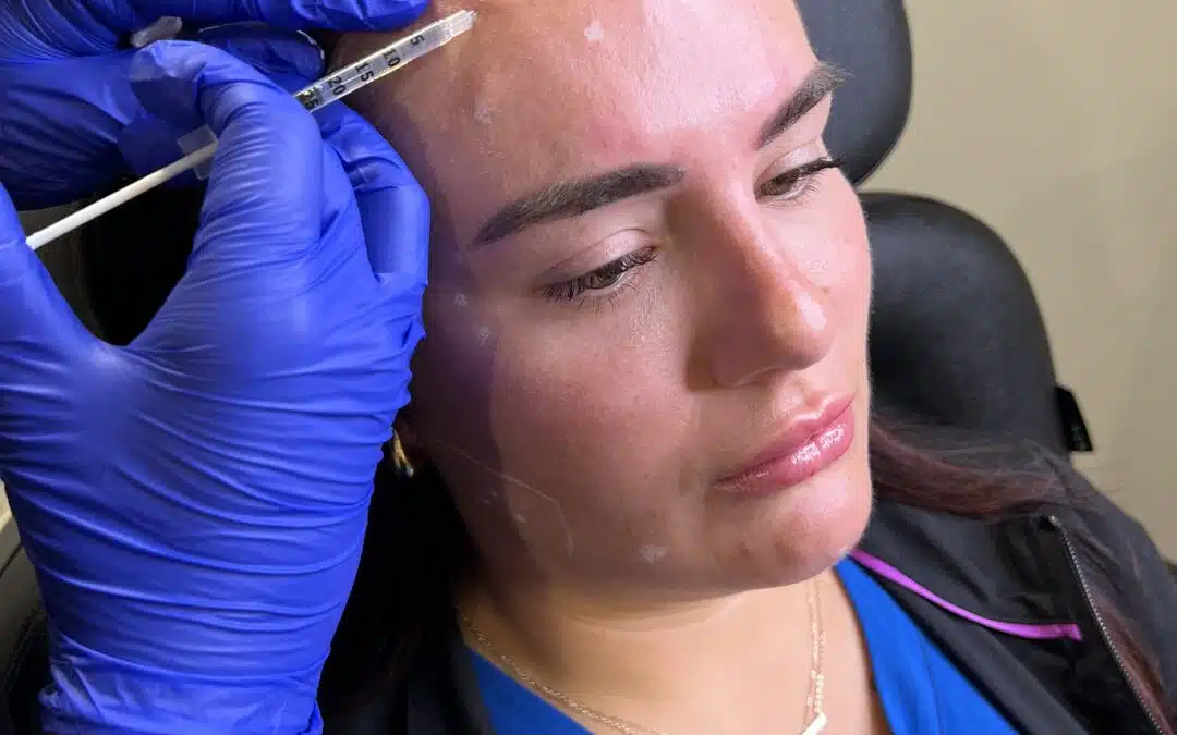 Forehead Line Rejuvenation: Dysport vs Botox Explained for Natural-Looking Results