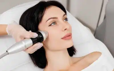 Erbium Laser vs RF Microneedling in Winston-Salem, NC: Which Treatment Is Right for Your Skin?