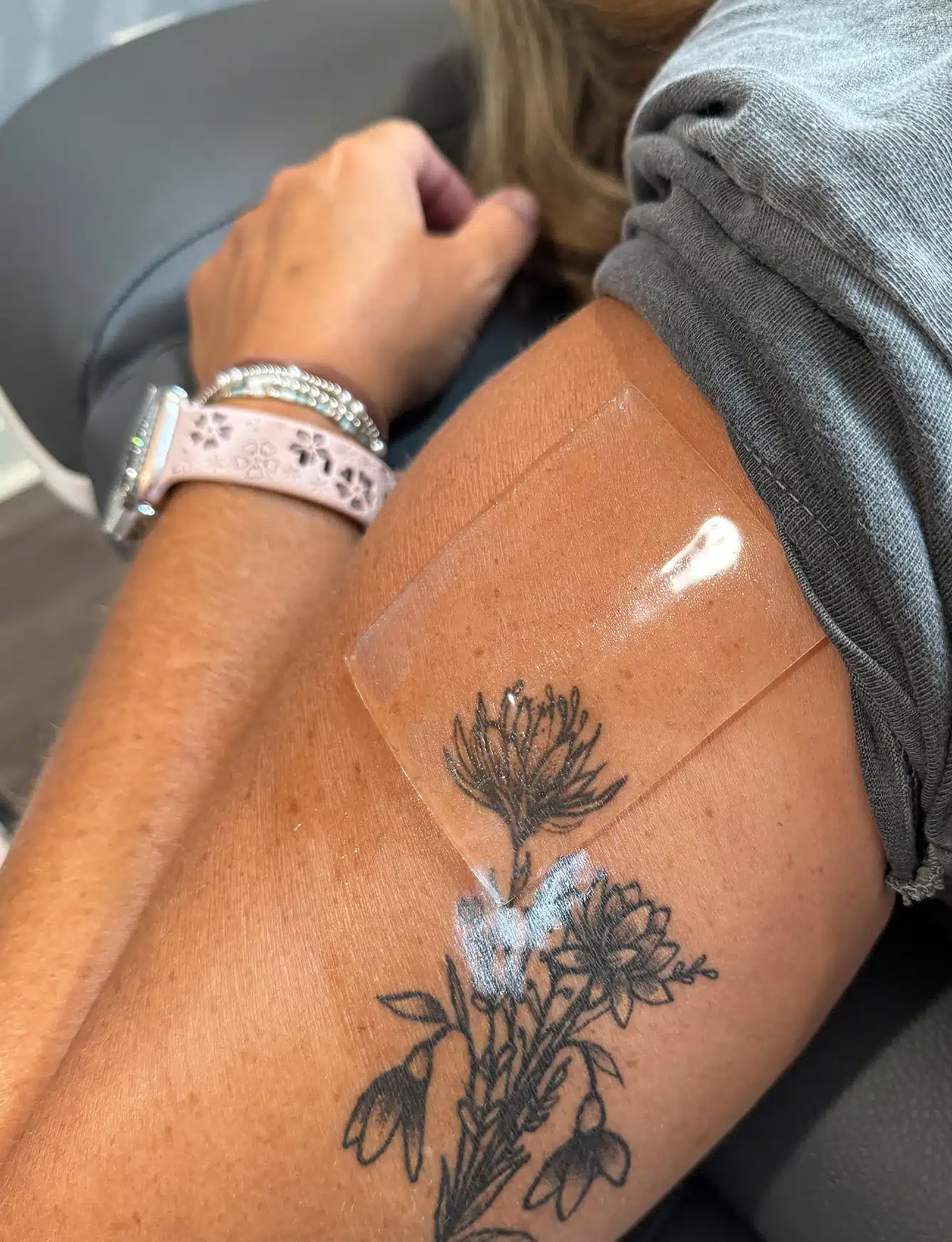 Expect During Your Treatment Session Expect from your Tattoo Removal Session