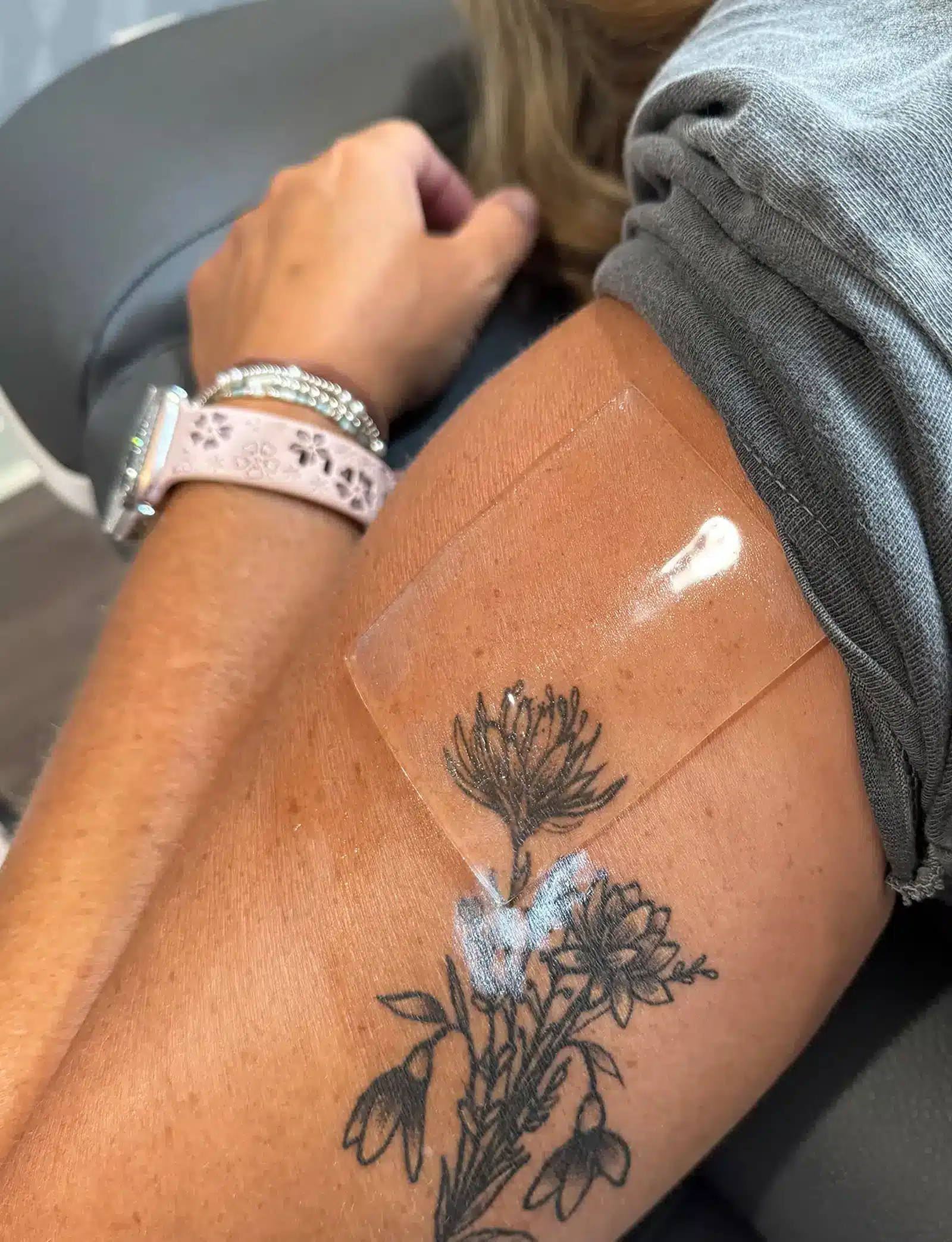 Expect from your Tattoo Removal Session