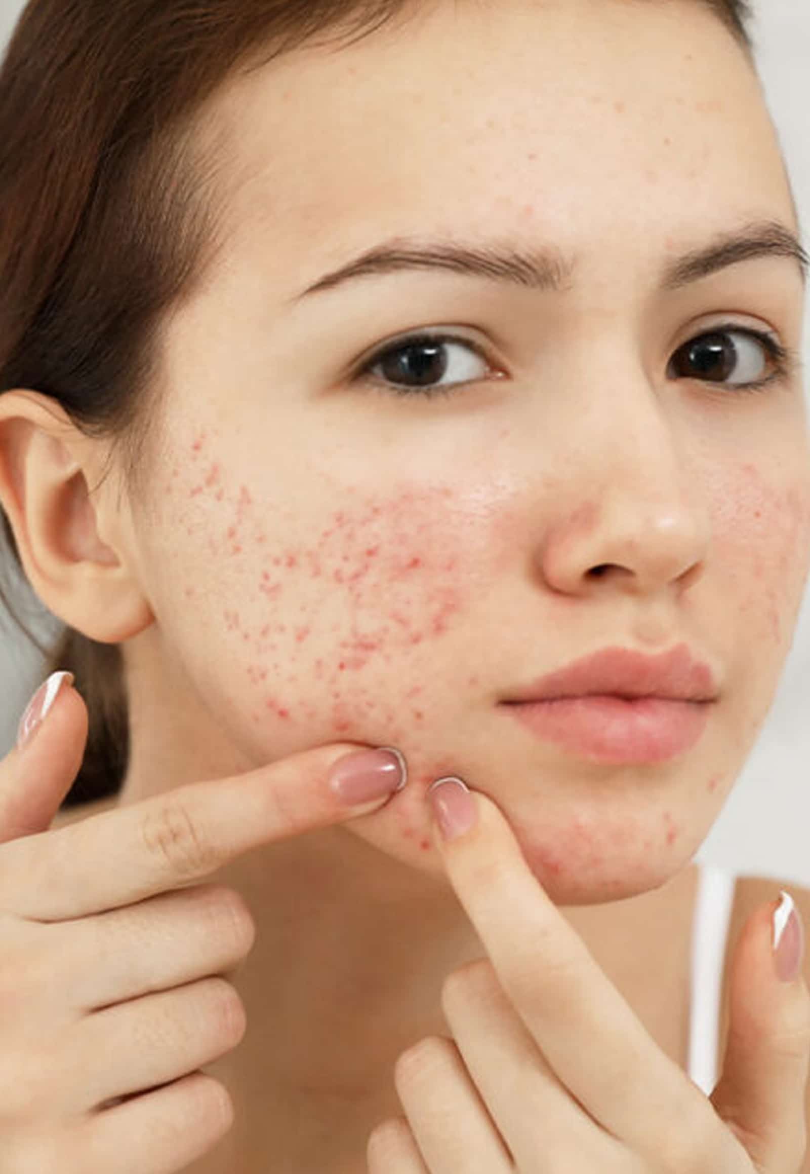 Advanced Laser Resurfacing for Structural Skin Renewal Chemical Peel Appointment