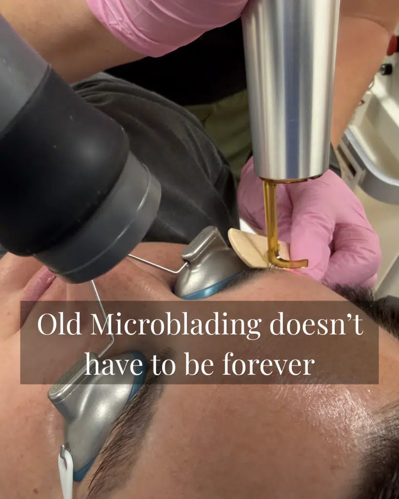 Microblading Removal Explained