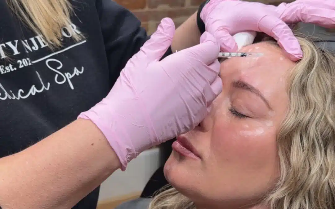 Dysport Explained: What It Is and How It Works for Wrinkle Reduction