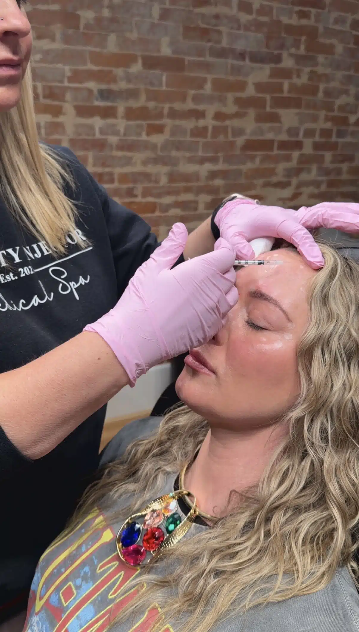 Dysport for Wrinkle Reduction