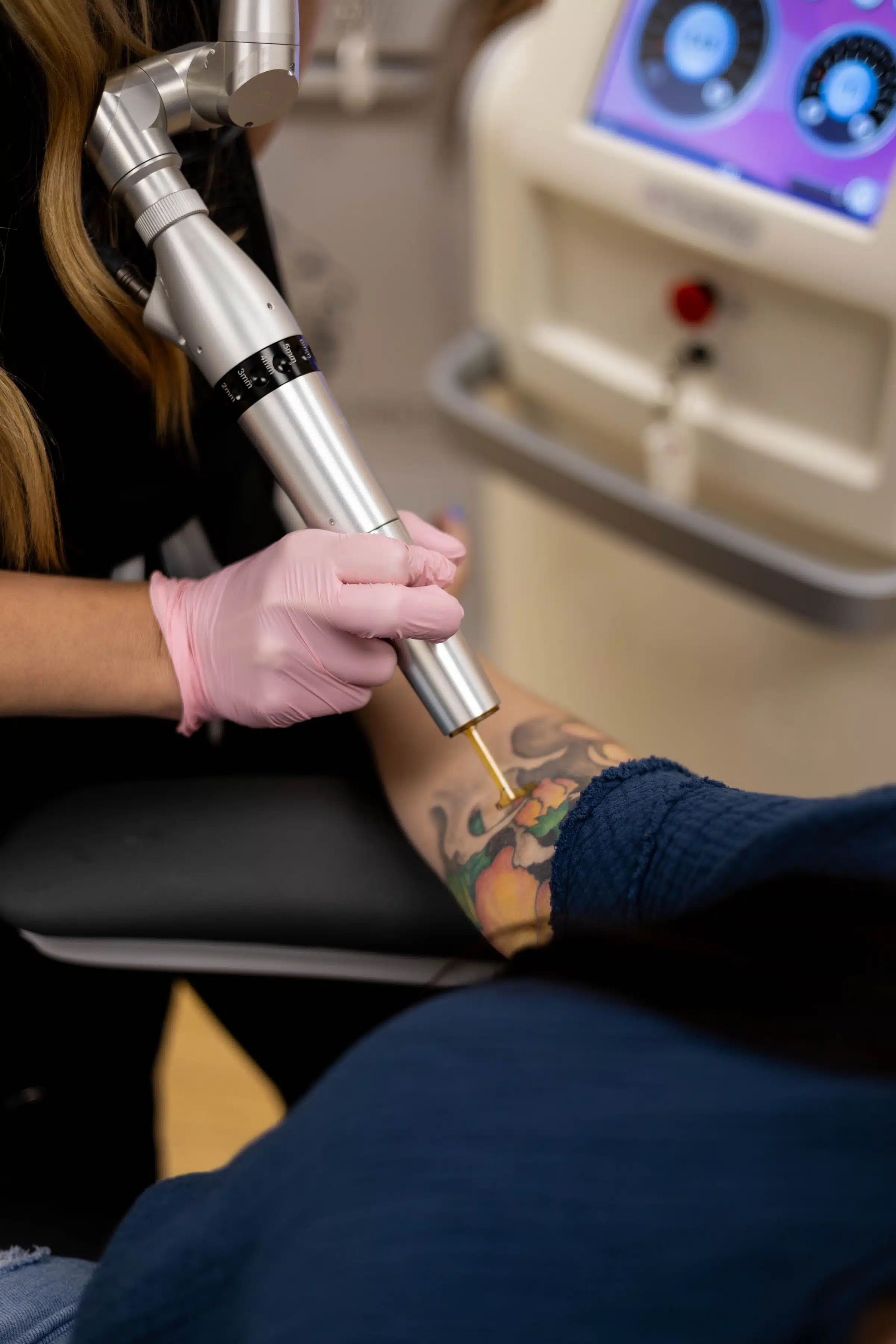 Laser resurfacing for skin texture and pores