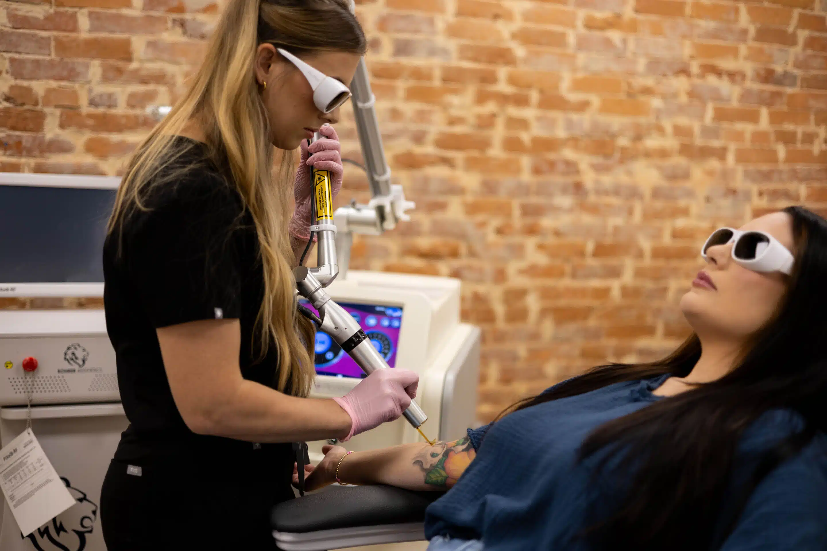 Laser resurfacing for acne scars in Winston-Salem