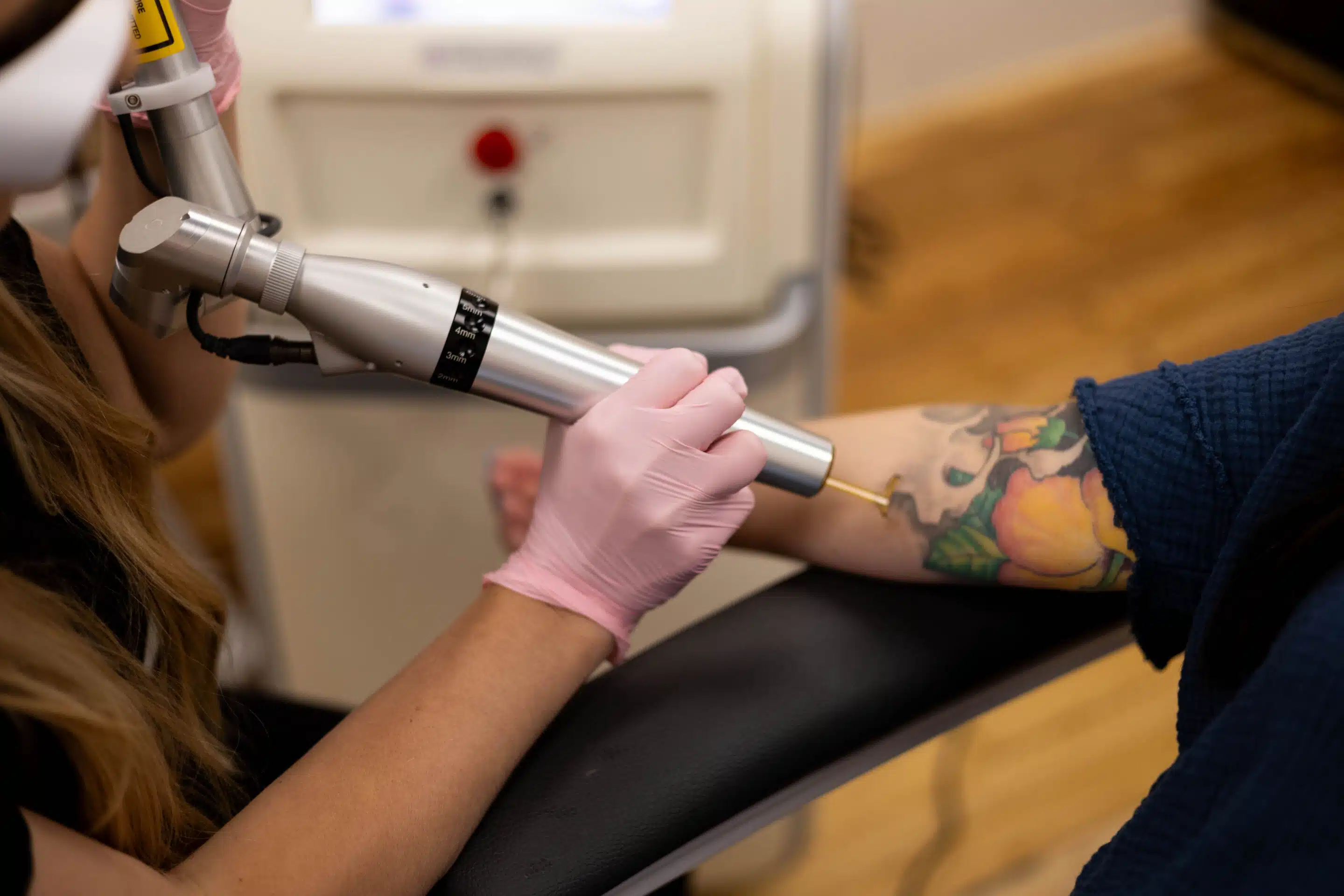 Laser skin resurfacing treatment at Camel City Injector