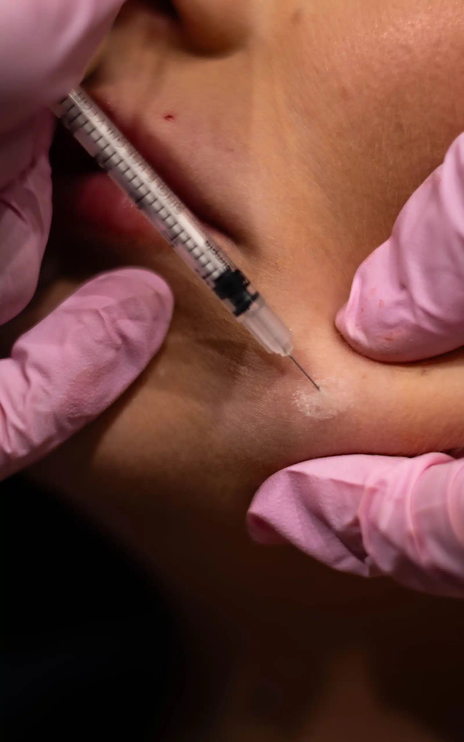 Daxxify Injections Winston Salem