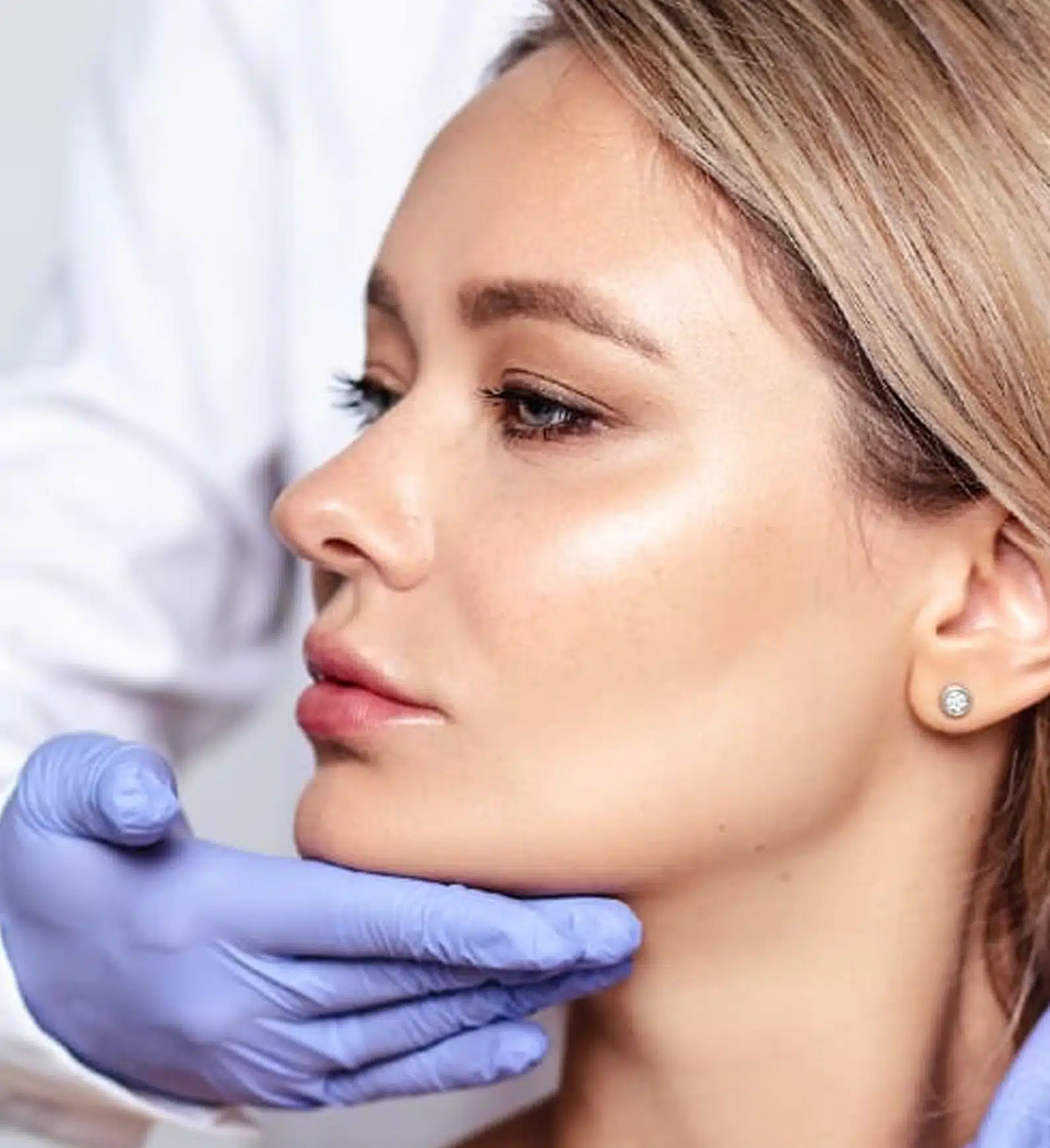 dermal filler designed to redefine