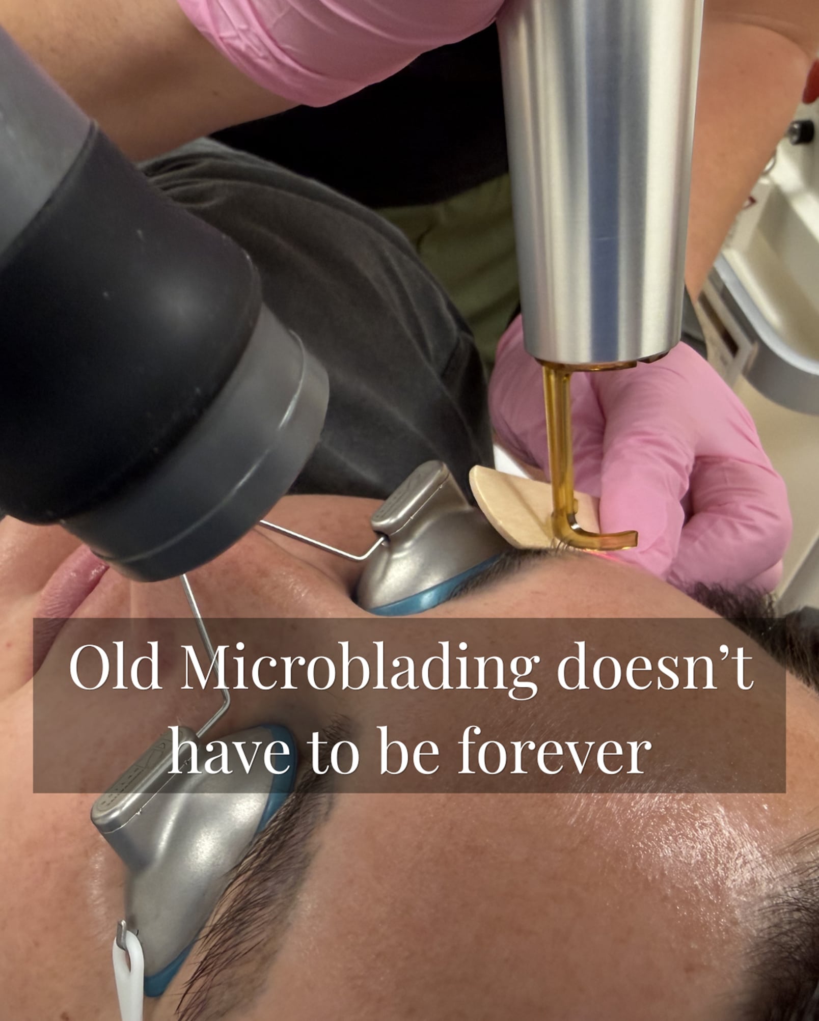 Detailed Consultation and Brow Assessment Recommendations for Optimal Results