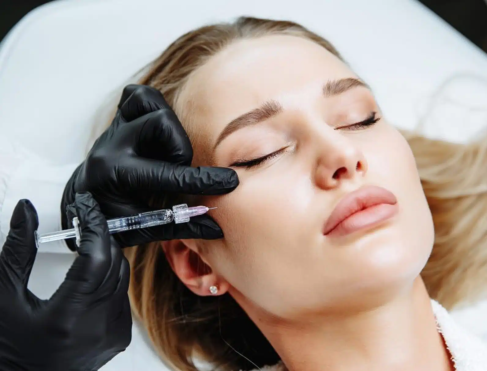 dermal filler designed to redefine