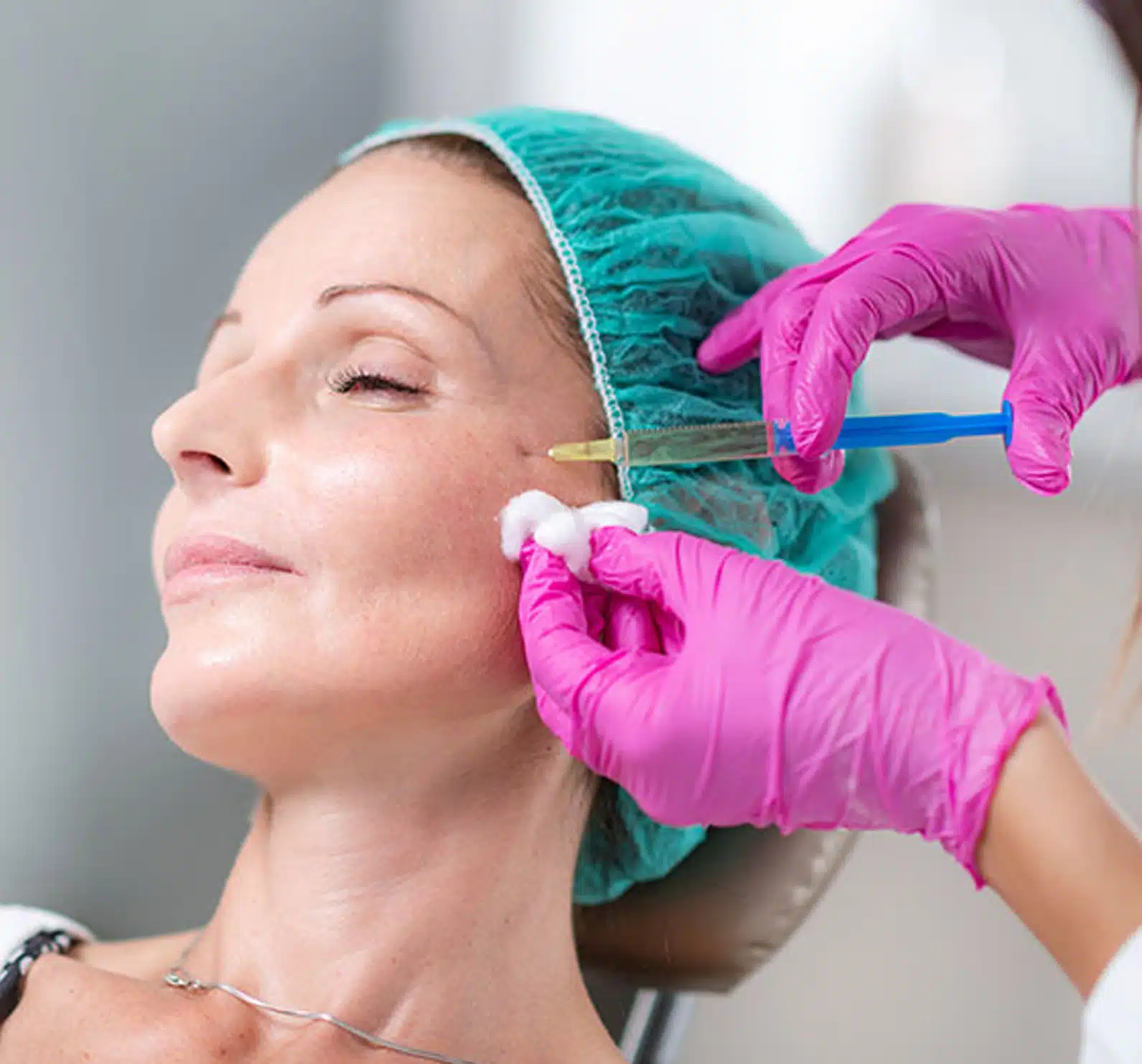 dermal filler designed to redefine