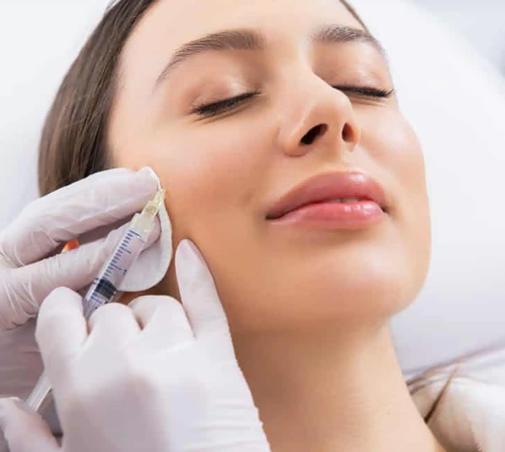 dermal filler designed to redefine