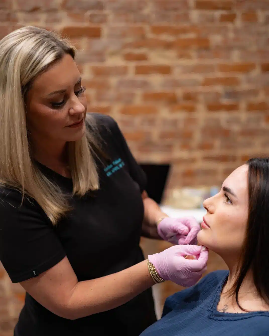Gummy smile Botox injection at Camel City Injector near Winston-Salem Gummy smile Botox injection at Camel City Injector near Winston-Salem