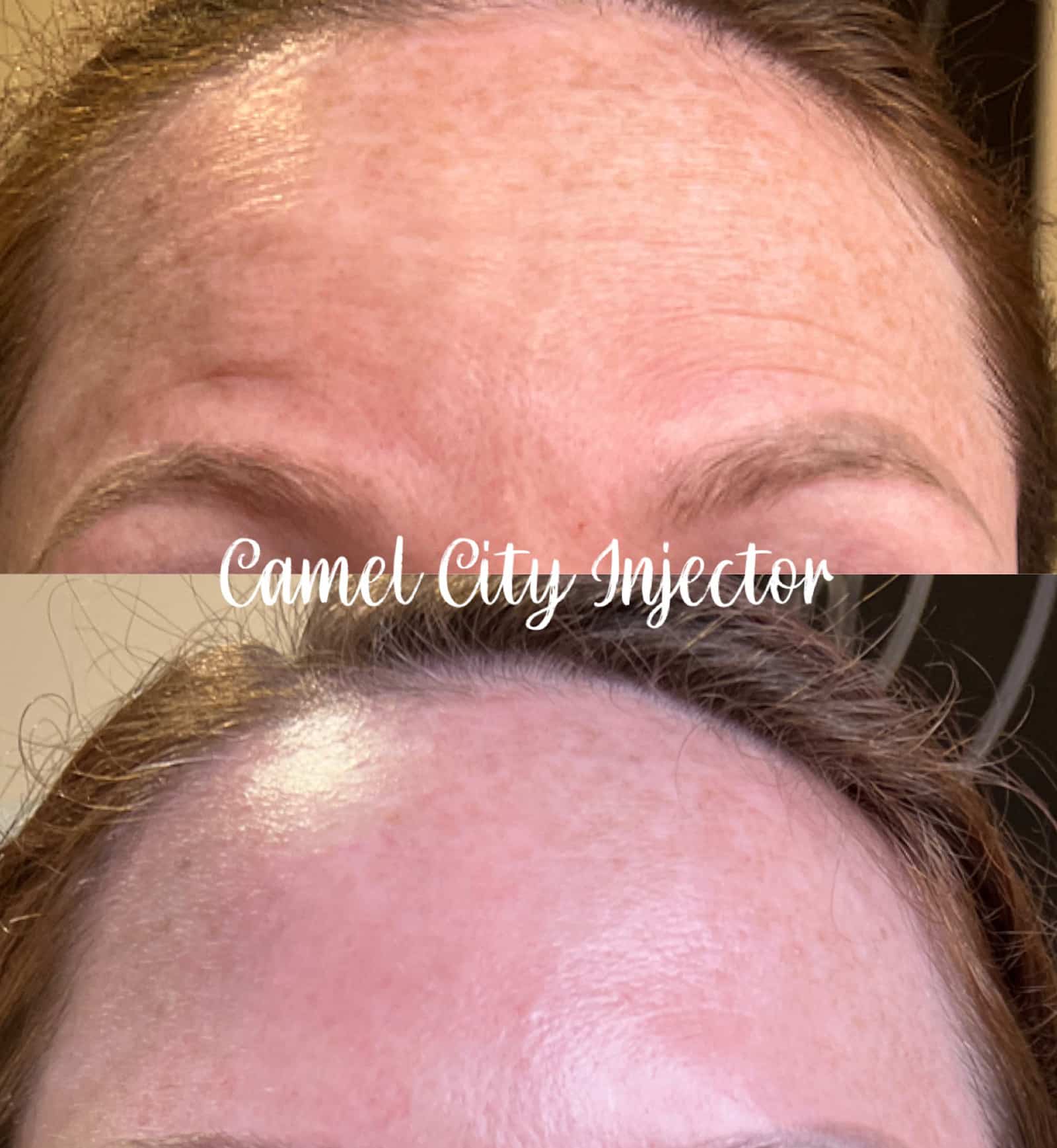 chemical peel Used in NC Clinics Aftercare Tips for Optimal Results