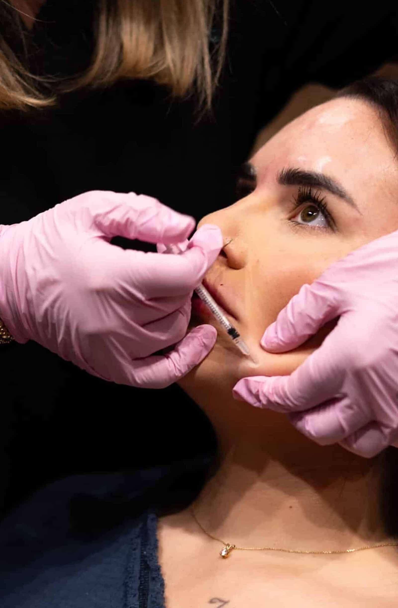 Botox Gummy Smile Dilemma Daxxify Injections Winston Salem