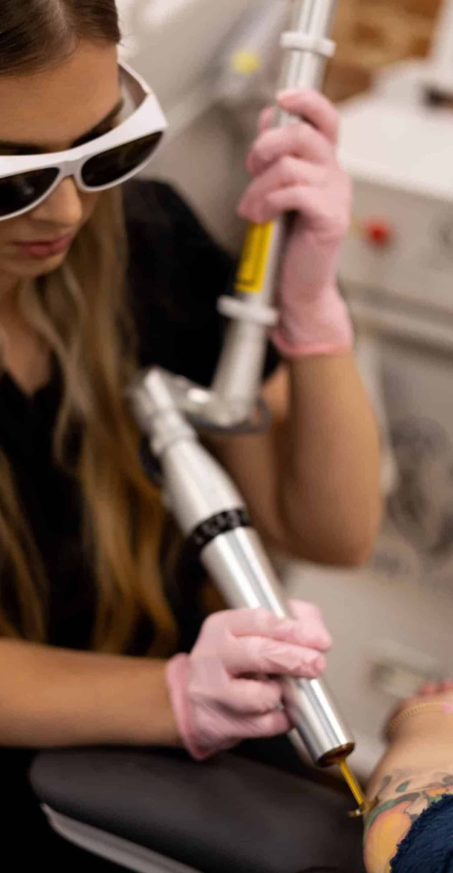Fractional Laser Technology Chemical Peels Treat