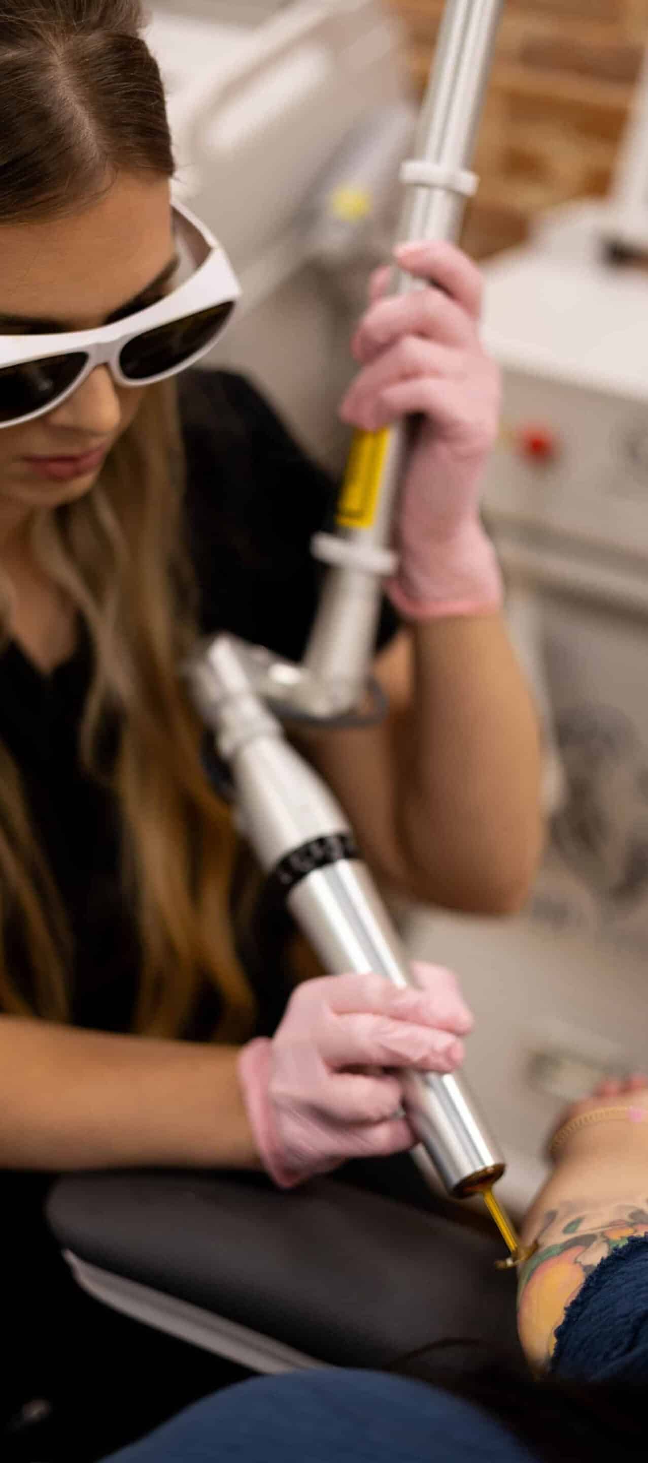 Fractional Laser Technology Chemical Peels Treat