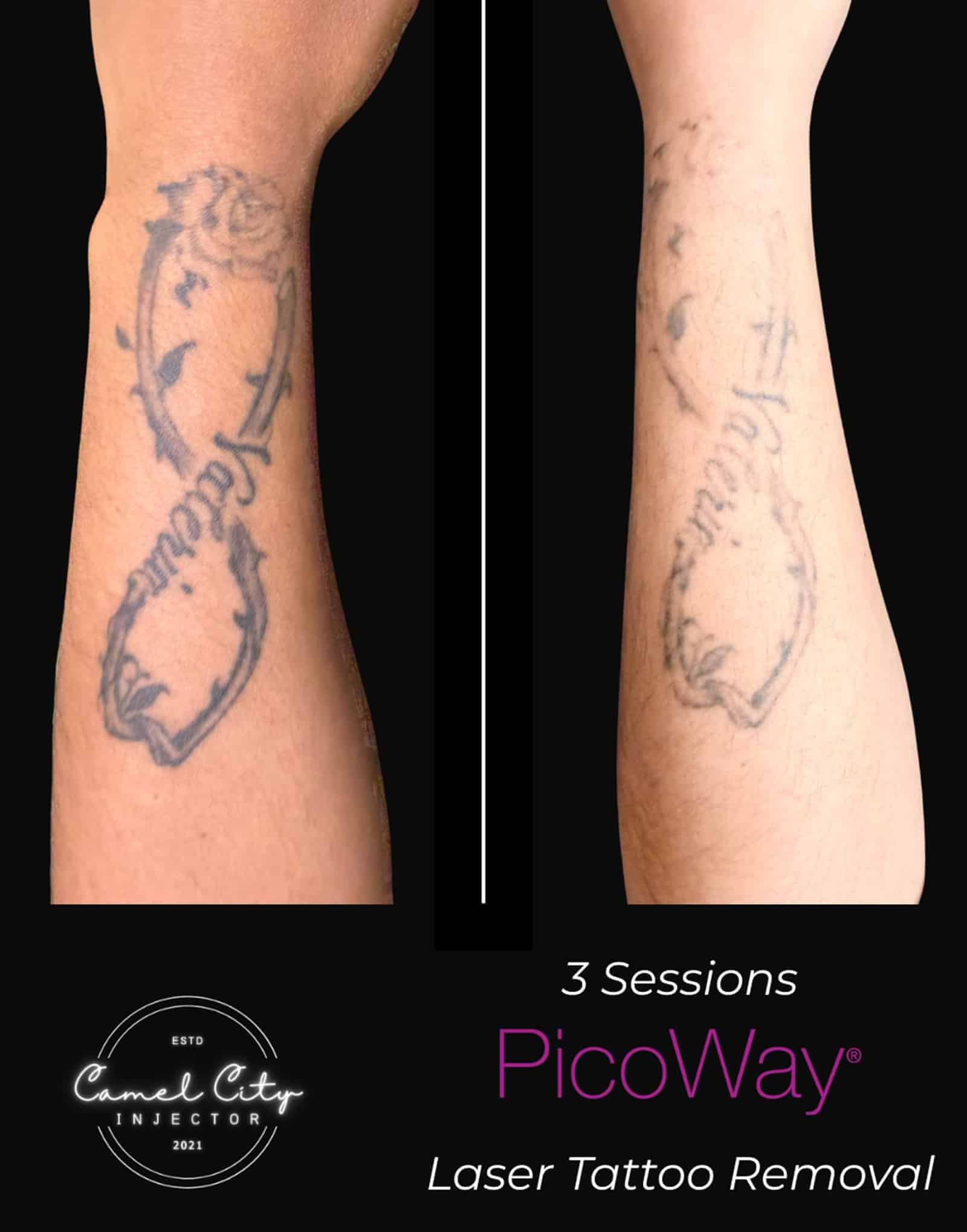 Reveal Your True Skin Personalized Treatment Plans Designed