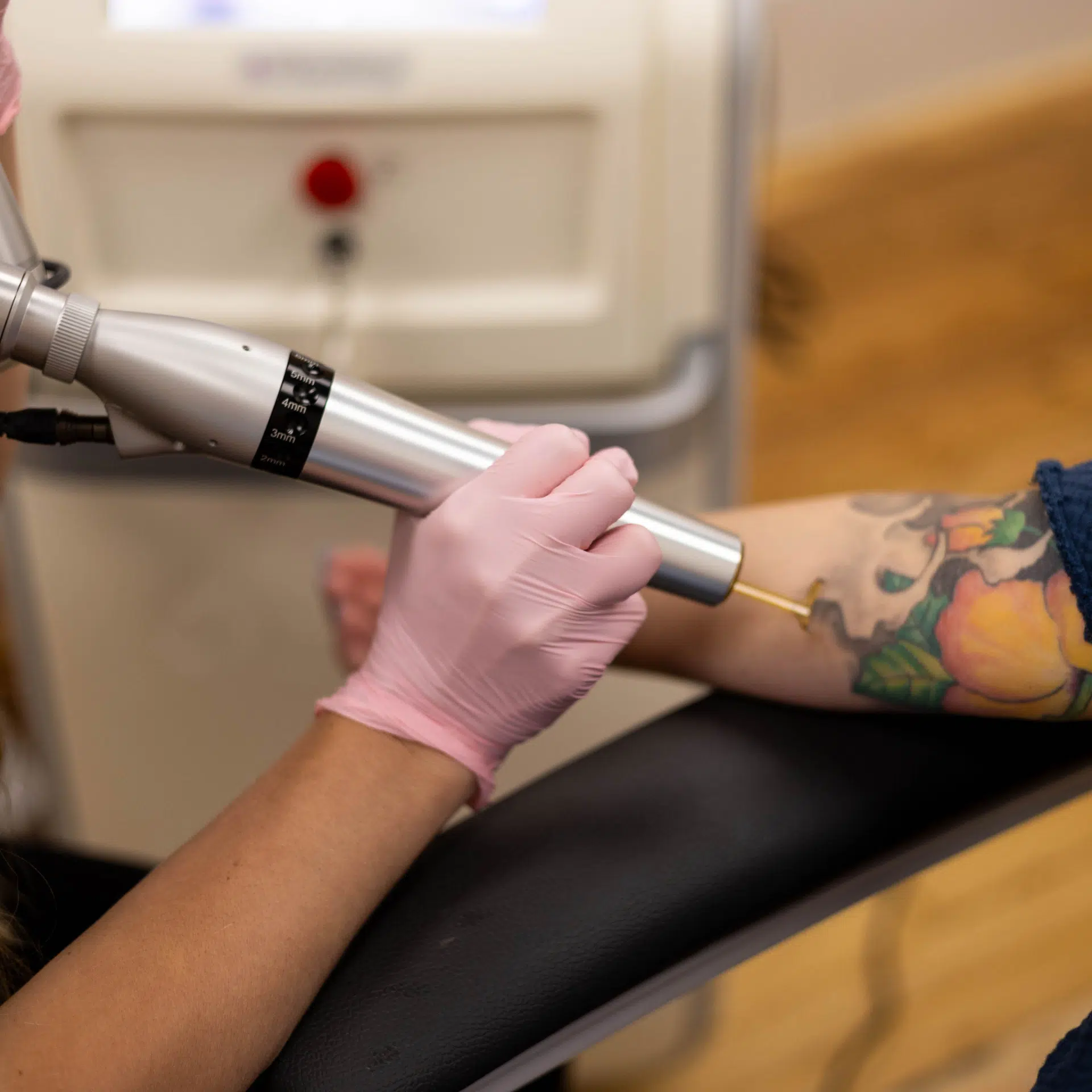 picoway tattoo removal picoway tattoo removal