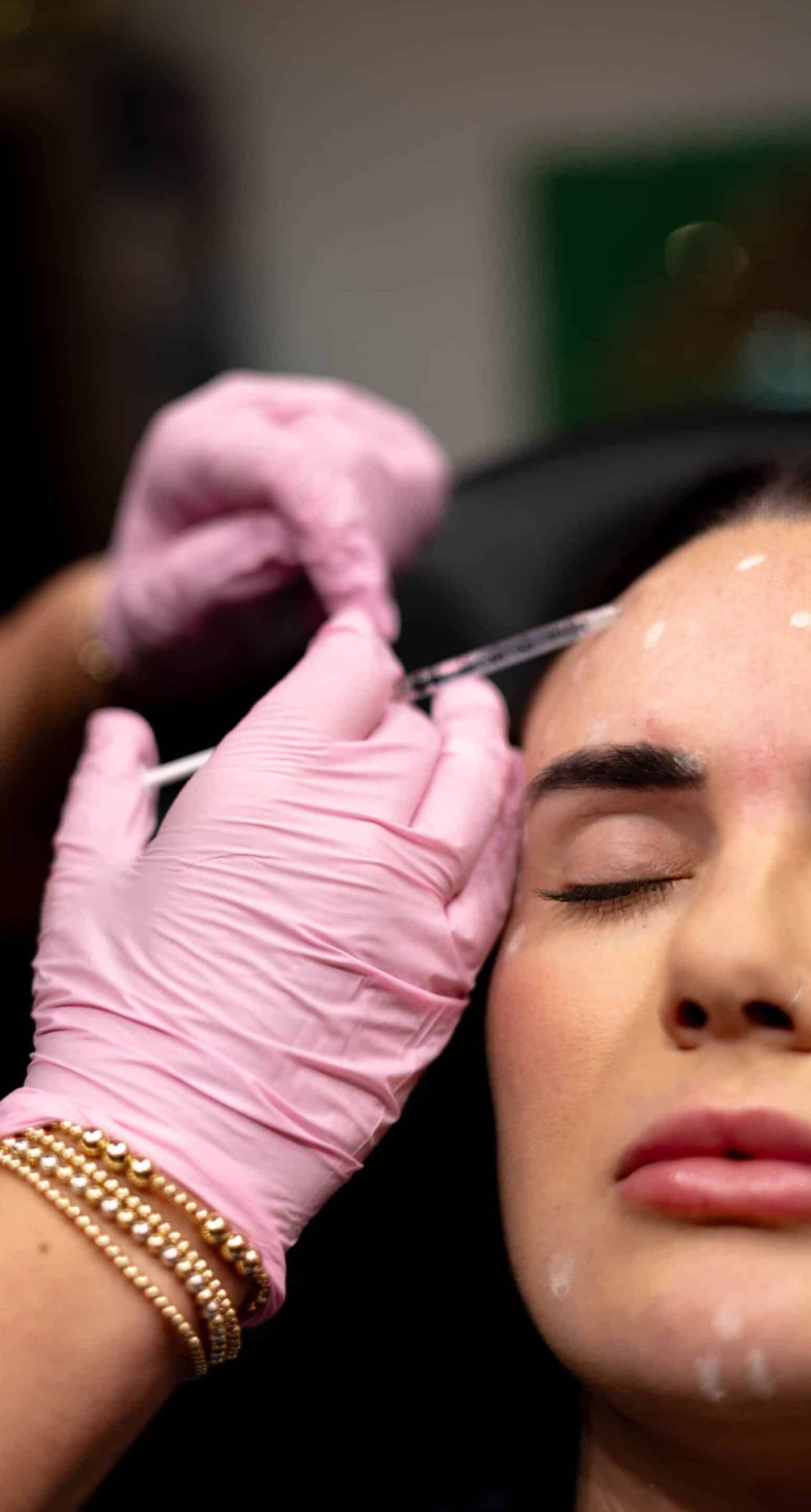 Botox or Dysport for year Chemical Peels Treat