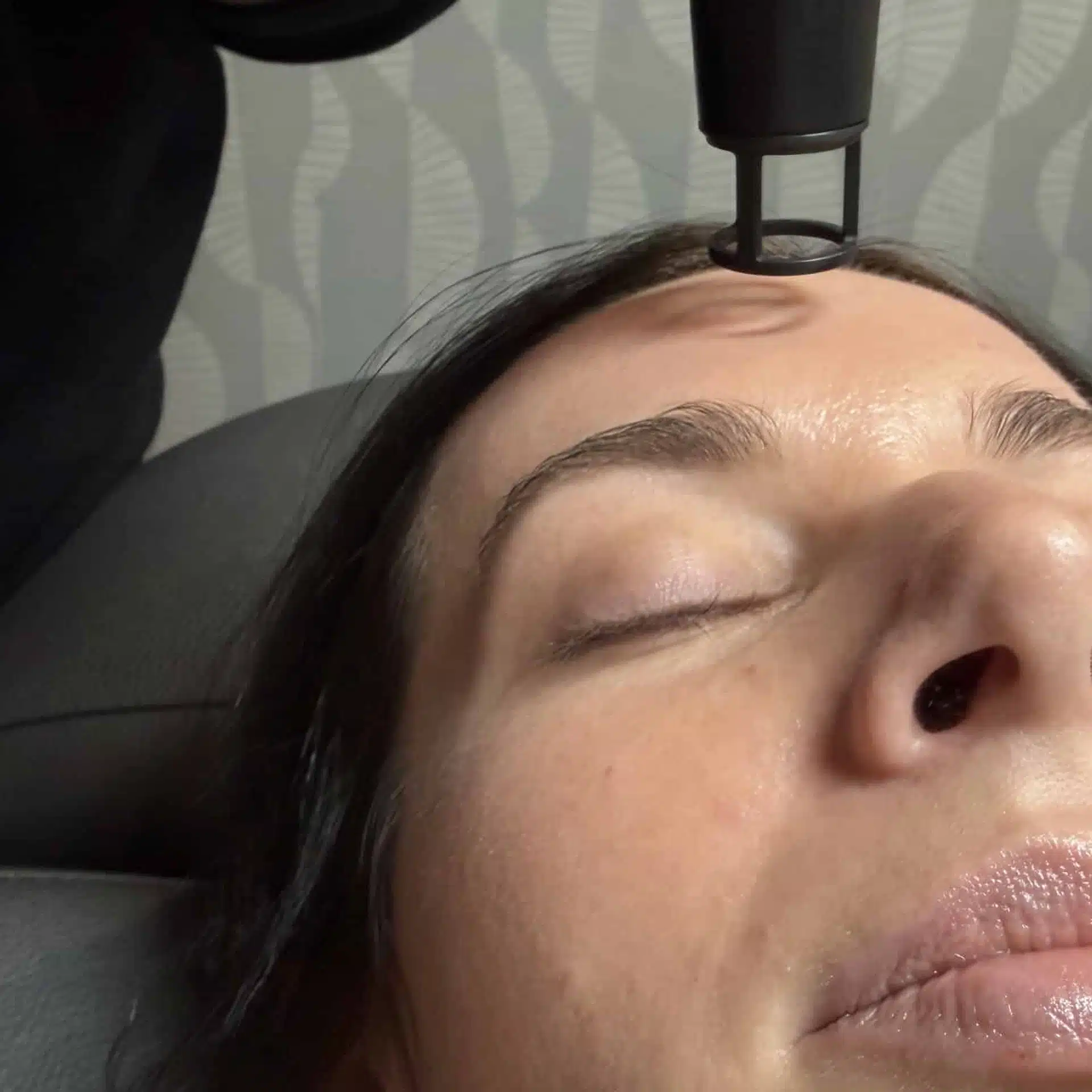 Laser Skin Resurfacing Winston Salem tattoo removal