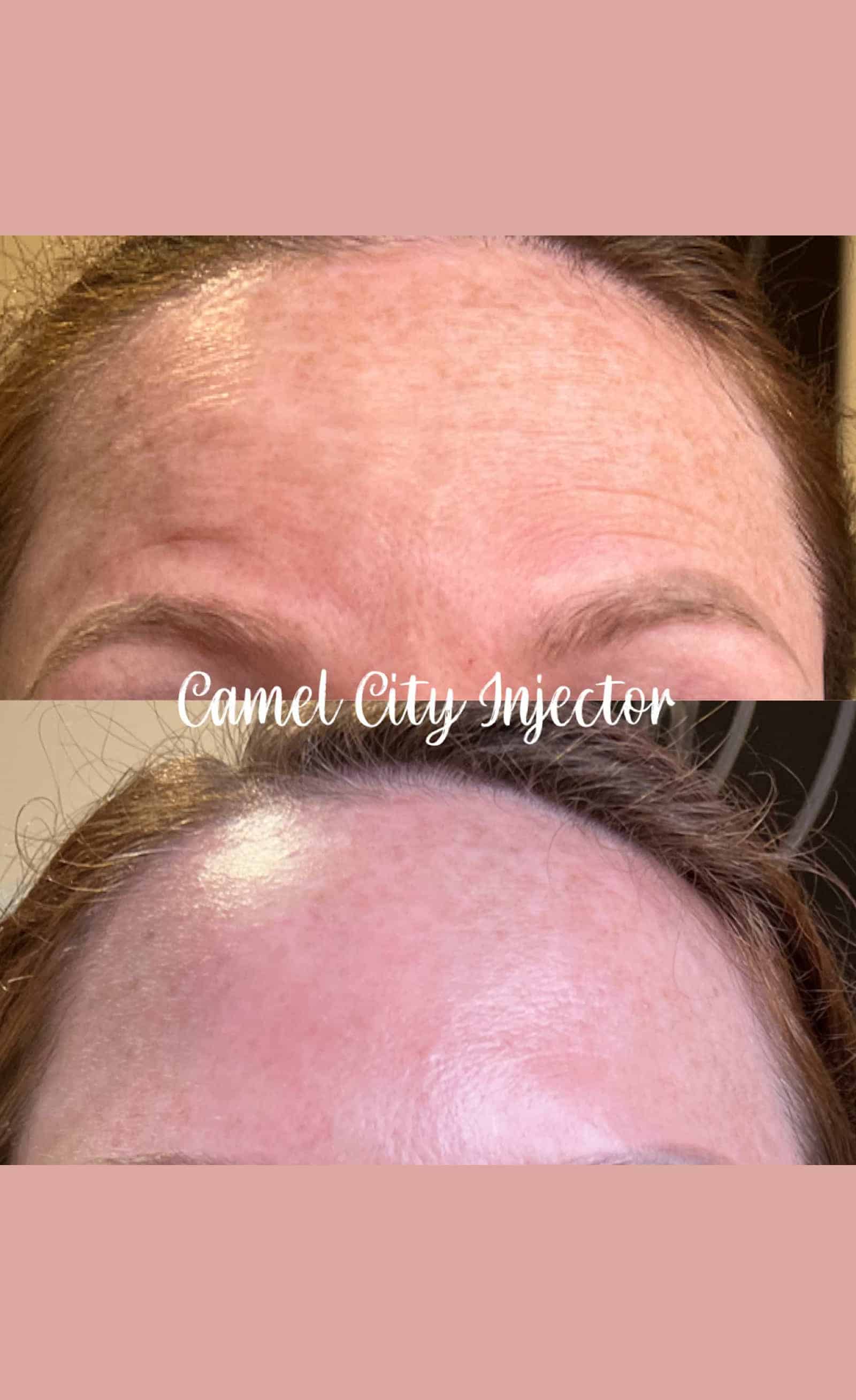 Step-by-Step Treatment Experience Aftercare Tips for Optimal Results