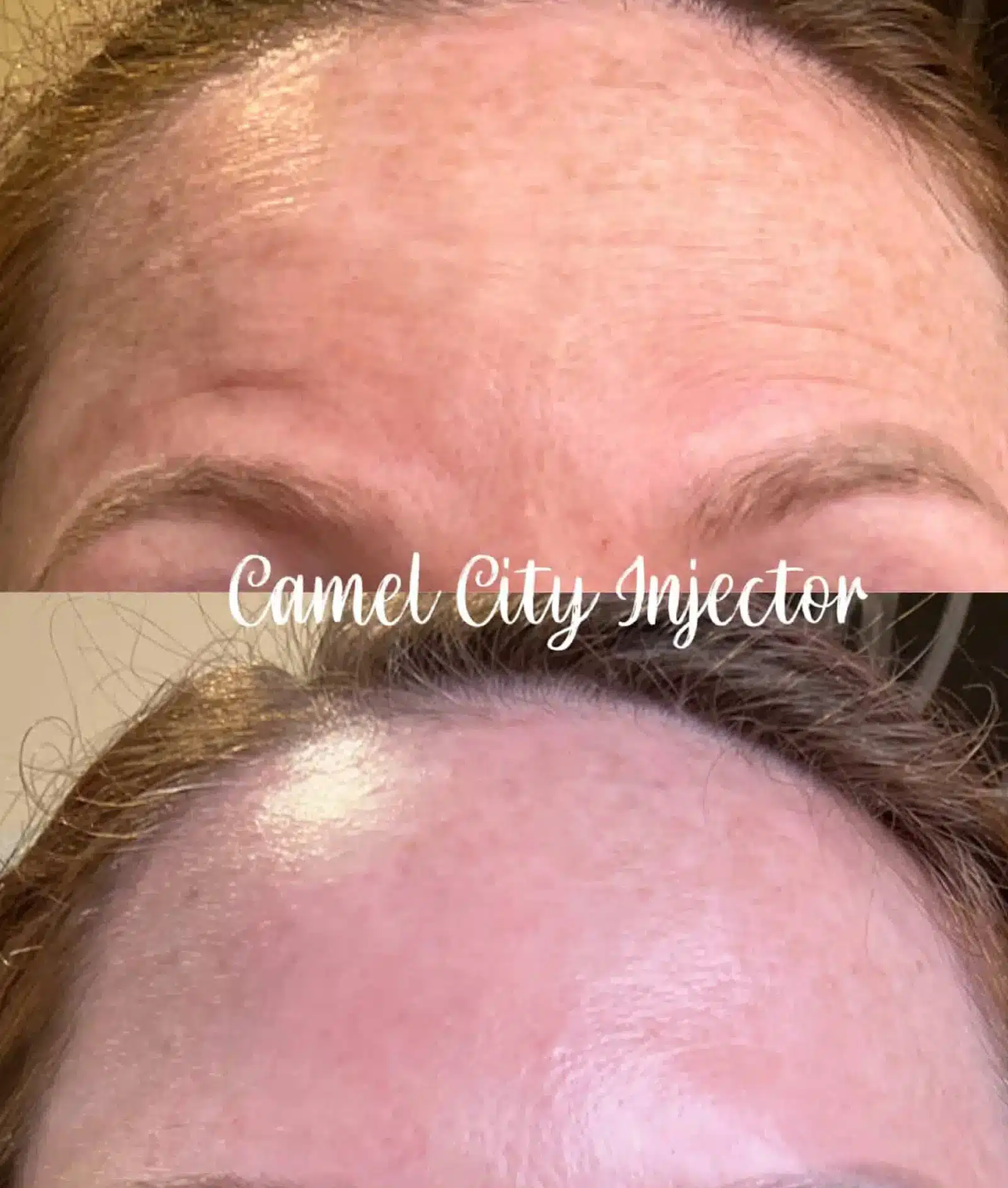 Aftercare Tips for Optimal Results