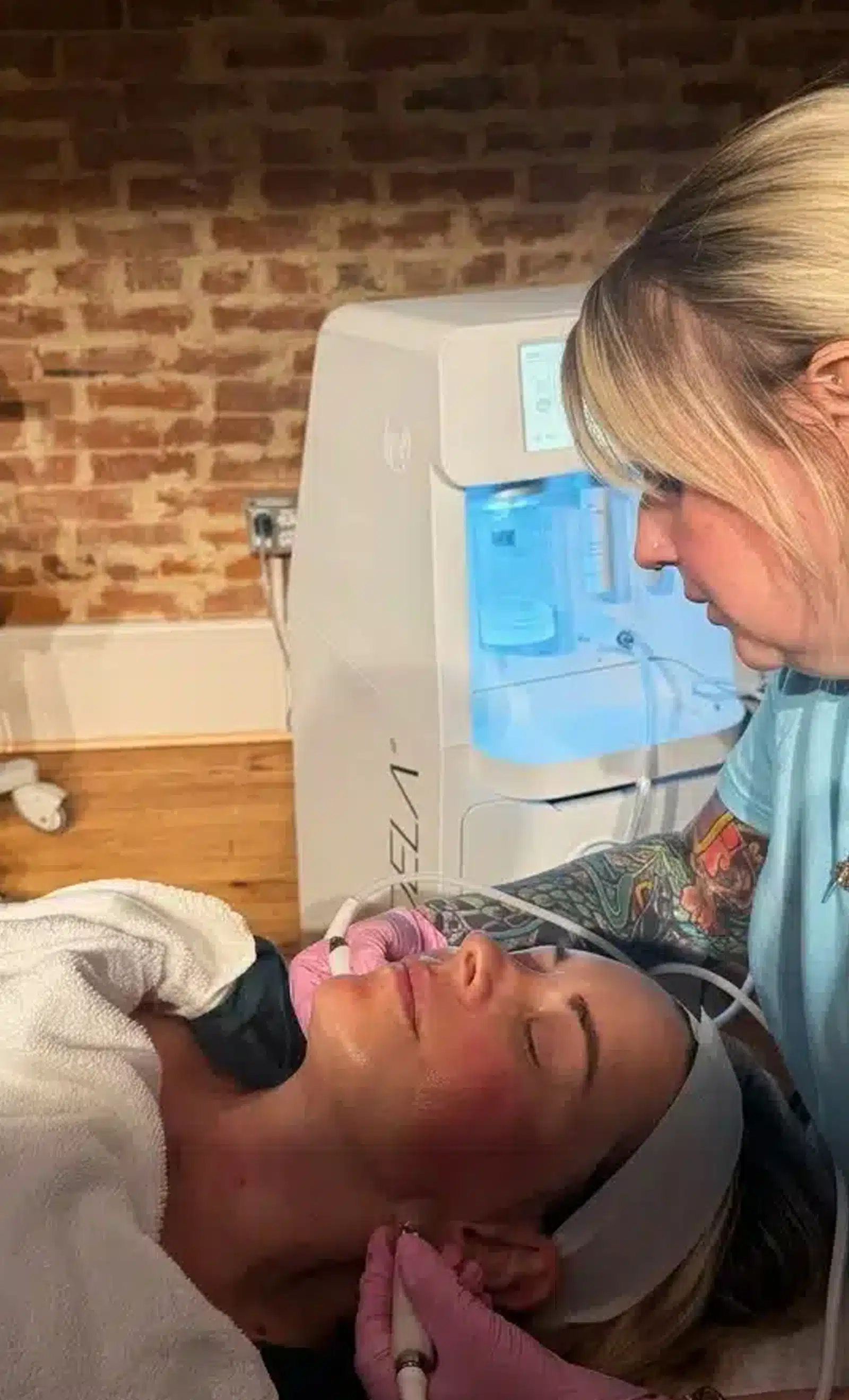 Chemical Peels Treat