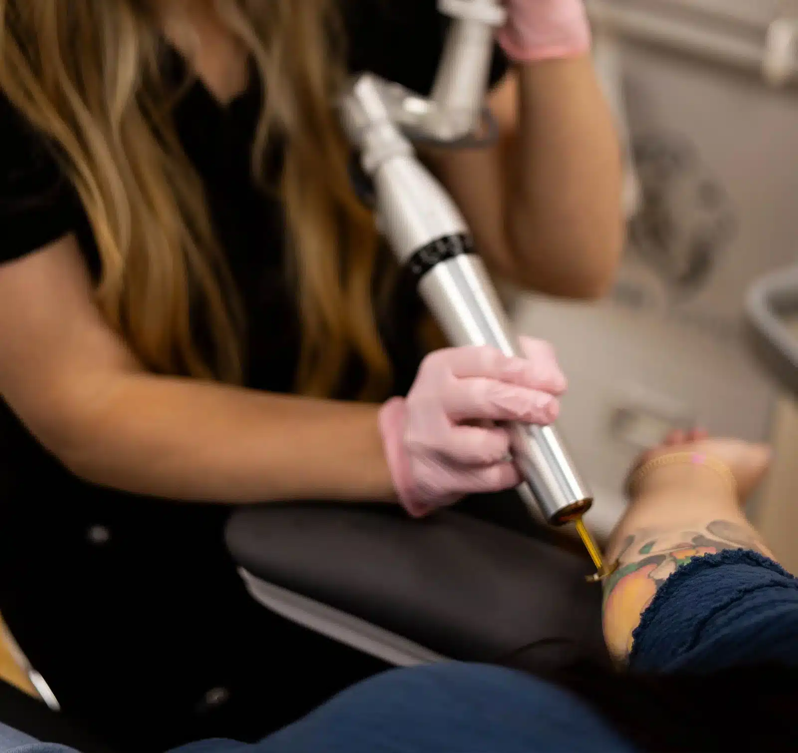 tattoo removal winston salem