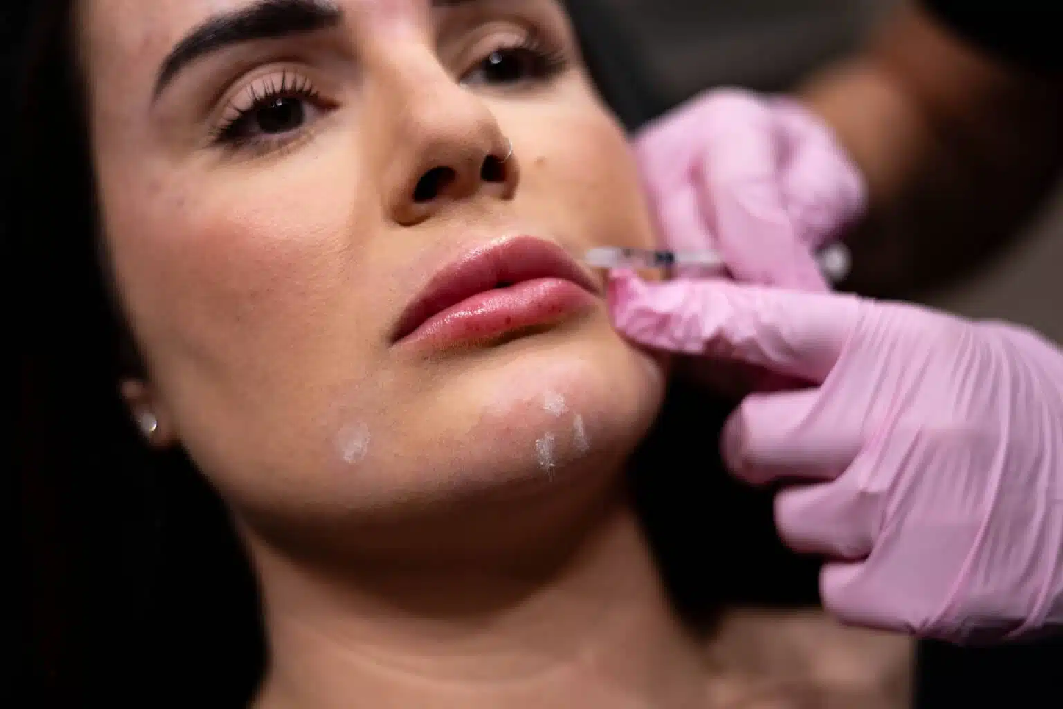 Botox injection close up at Camel City Injector, Mount Airy, NC, Neck Bands