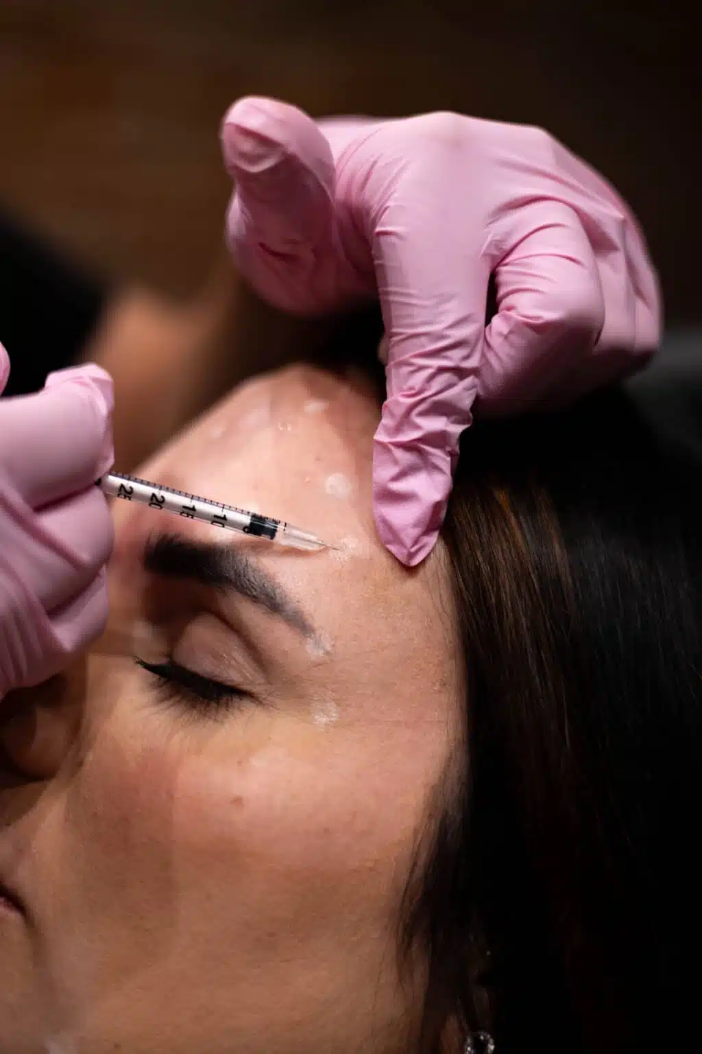 Botox injection at Camel City Injector serving Mount Airy, NC